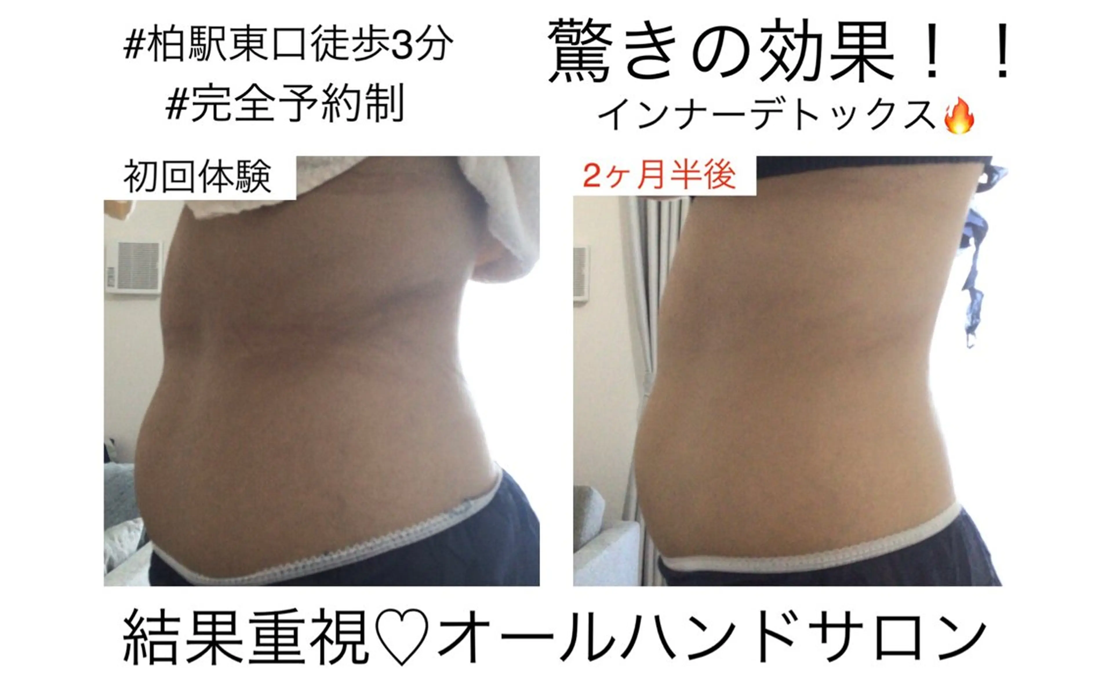 子宮矯正/腸揉み/ シュガーリング脱毛のエステ・リラクイメージ