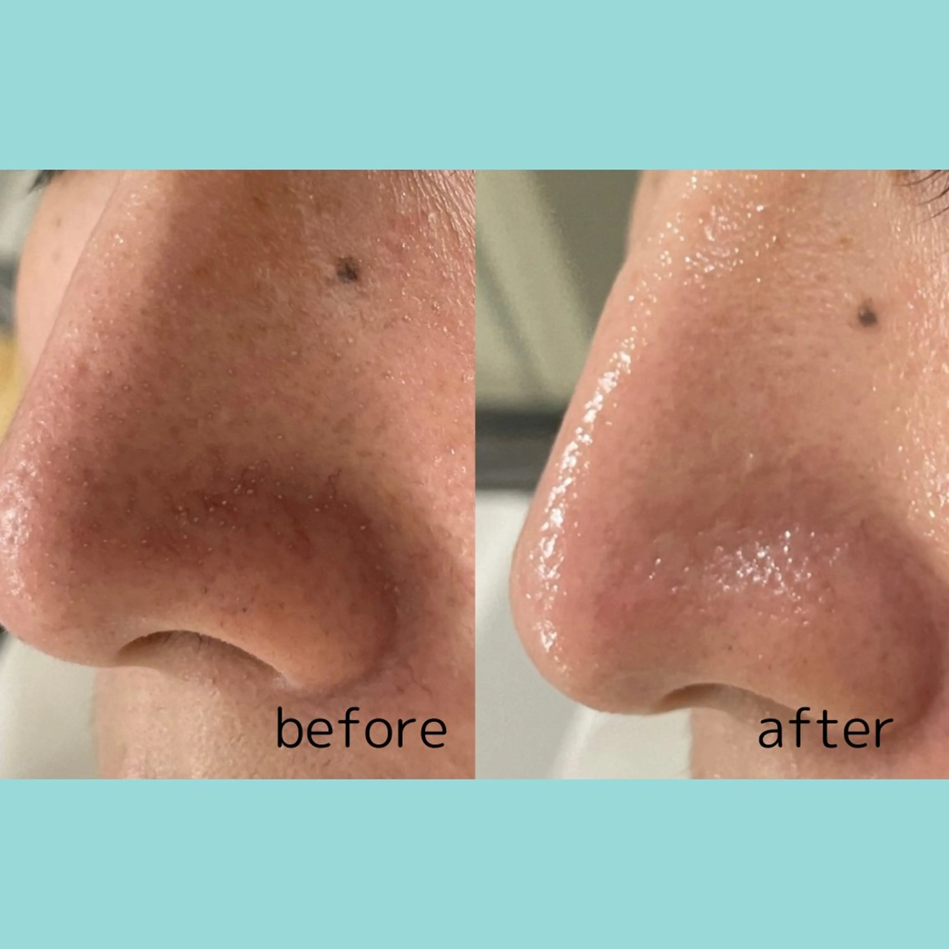 エステ DeI'm   名古屋栄所属・小林 玲菜のエステ・リラクイメージ