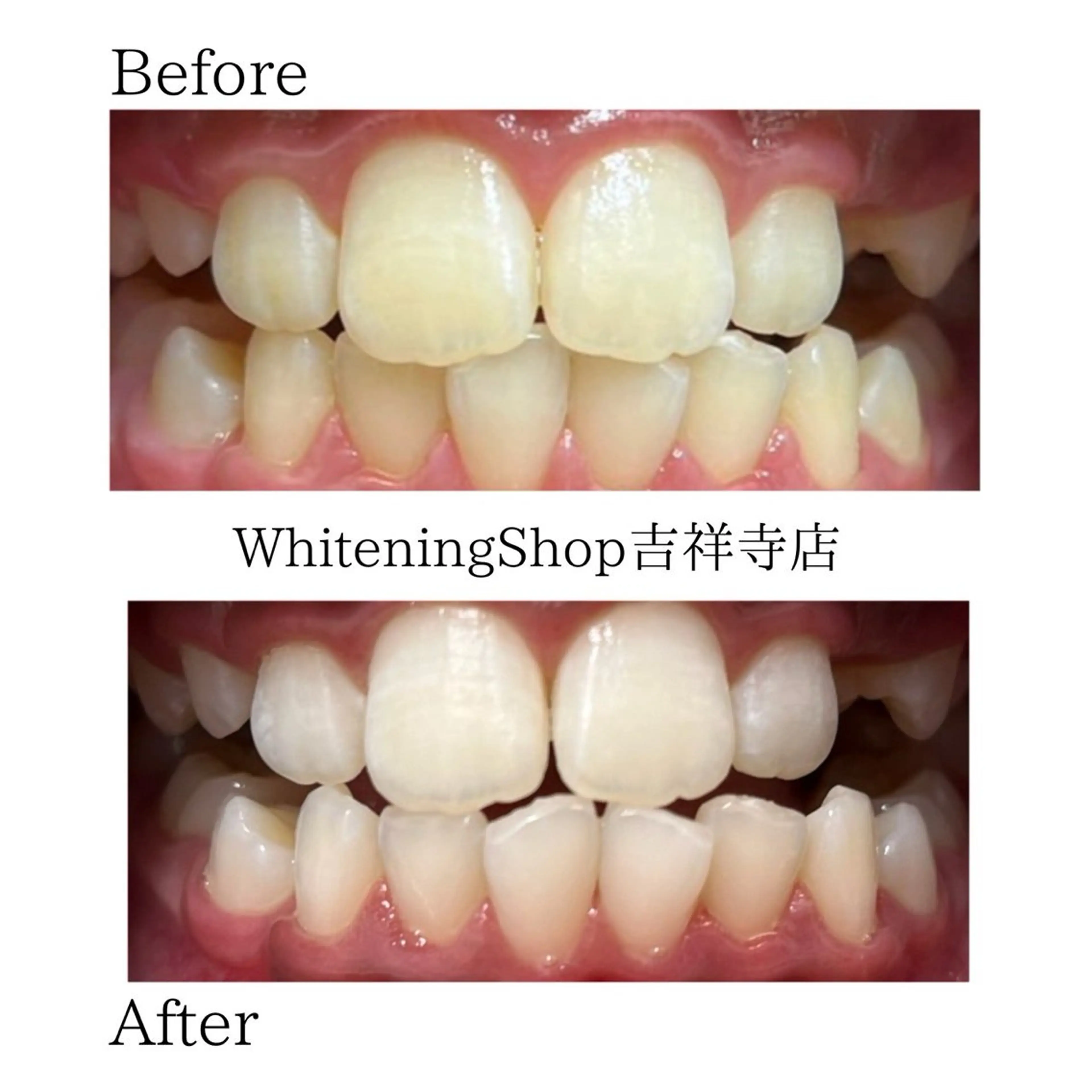 エステ リラク ホワイトニング ショップ吉祥寺店のエステ・リラクイメージ