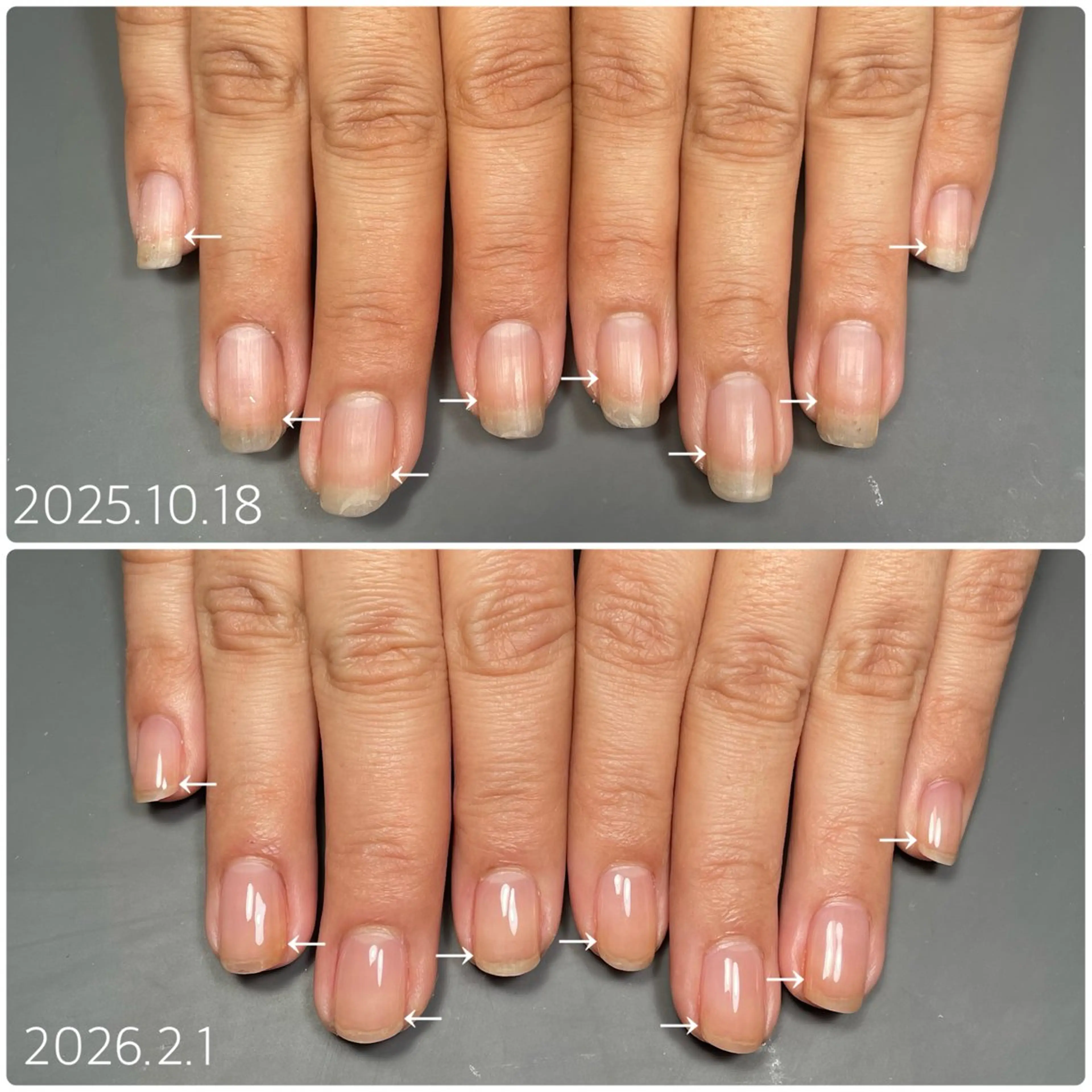 ネイル ハンドネイル 後藤 ももえのネイルデザイン