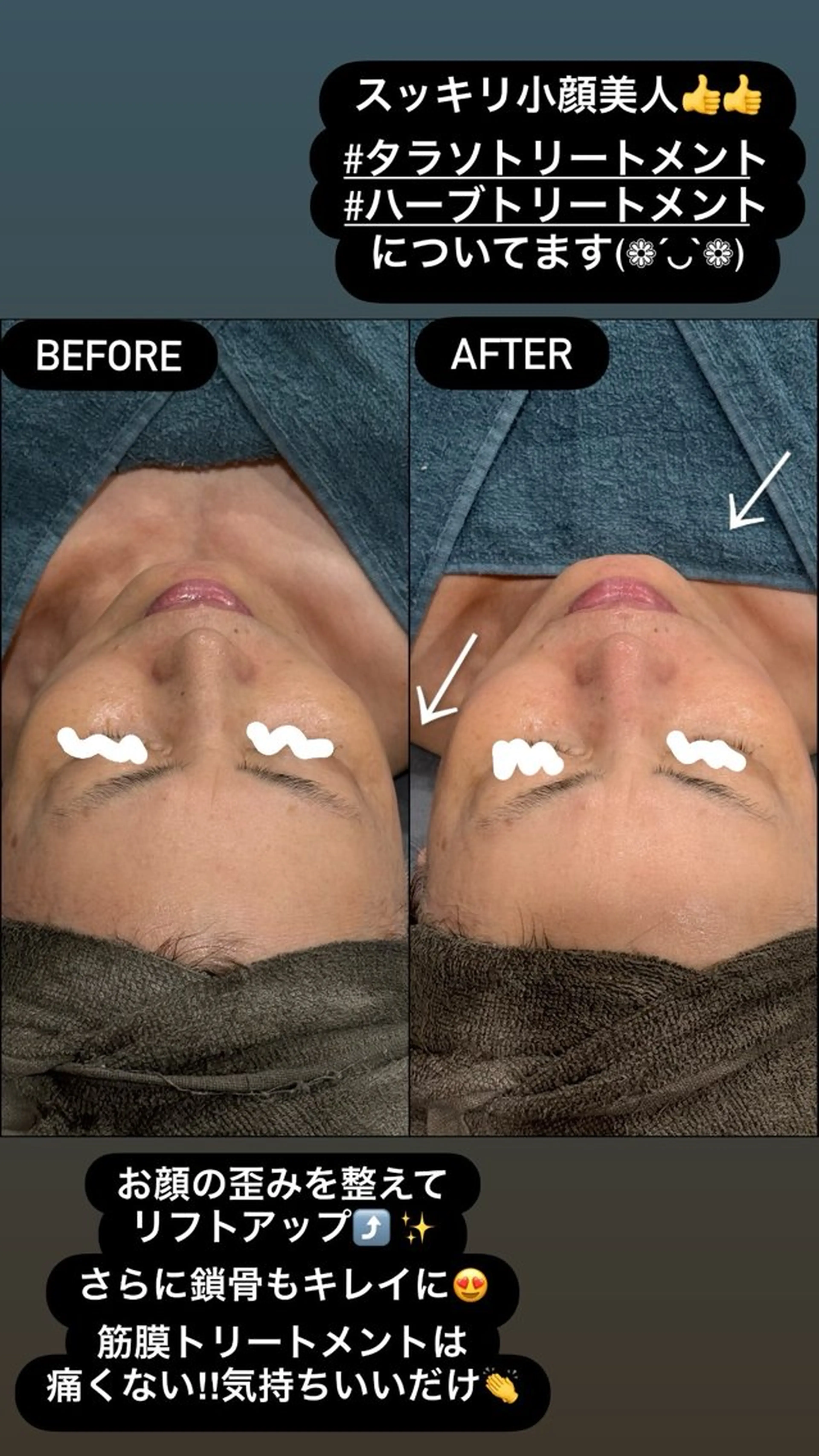 エステ LiZA エステティックサロンのエステ・リラクイメージ