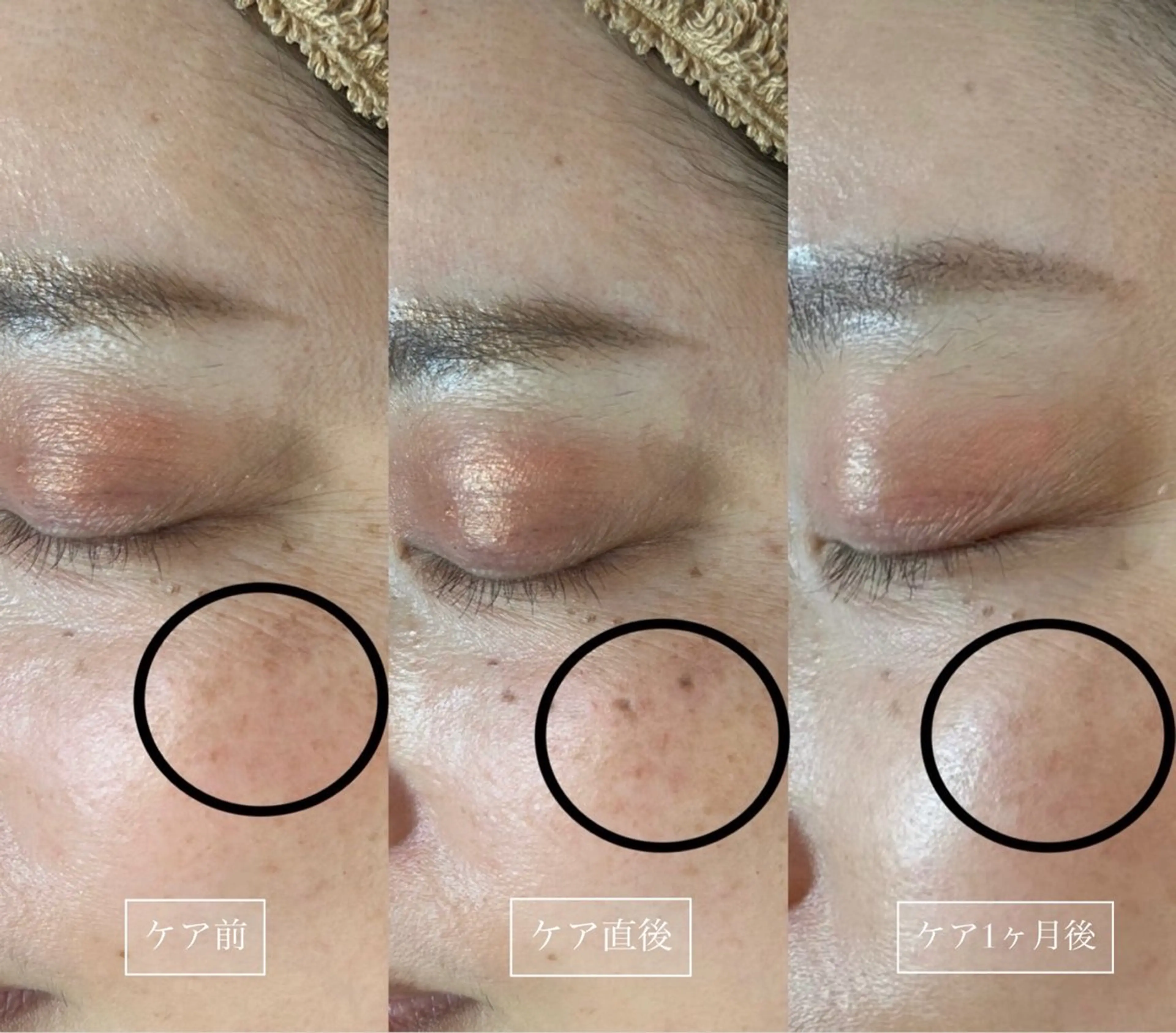 LUMY GRATiAEのエステ・リラクイメージ