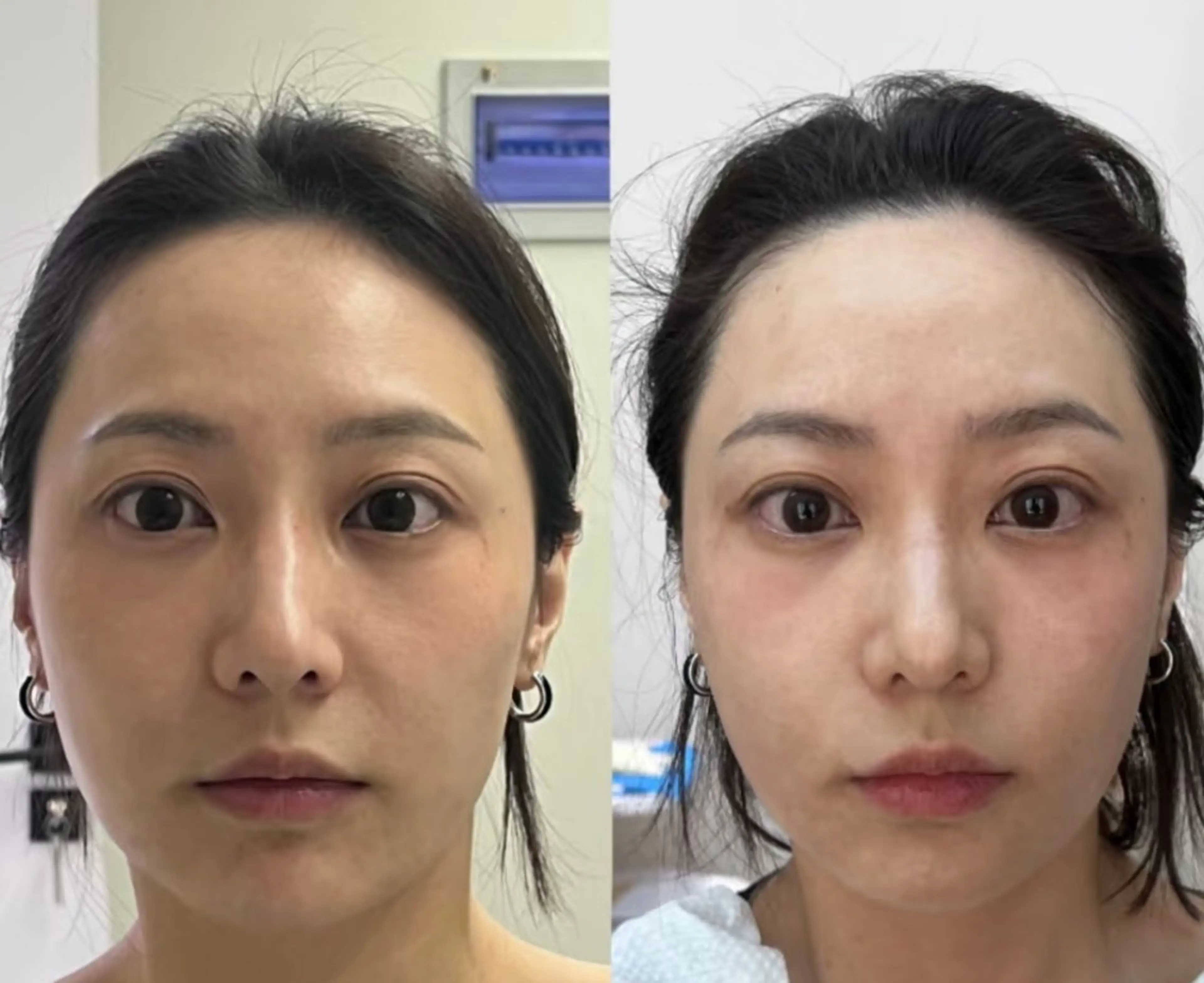 エステ aliaハイフ&水光ジェットサロン所属・aliaハーブ水光店 エステティシャン募集のエステ・リラクイメージ