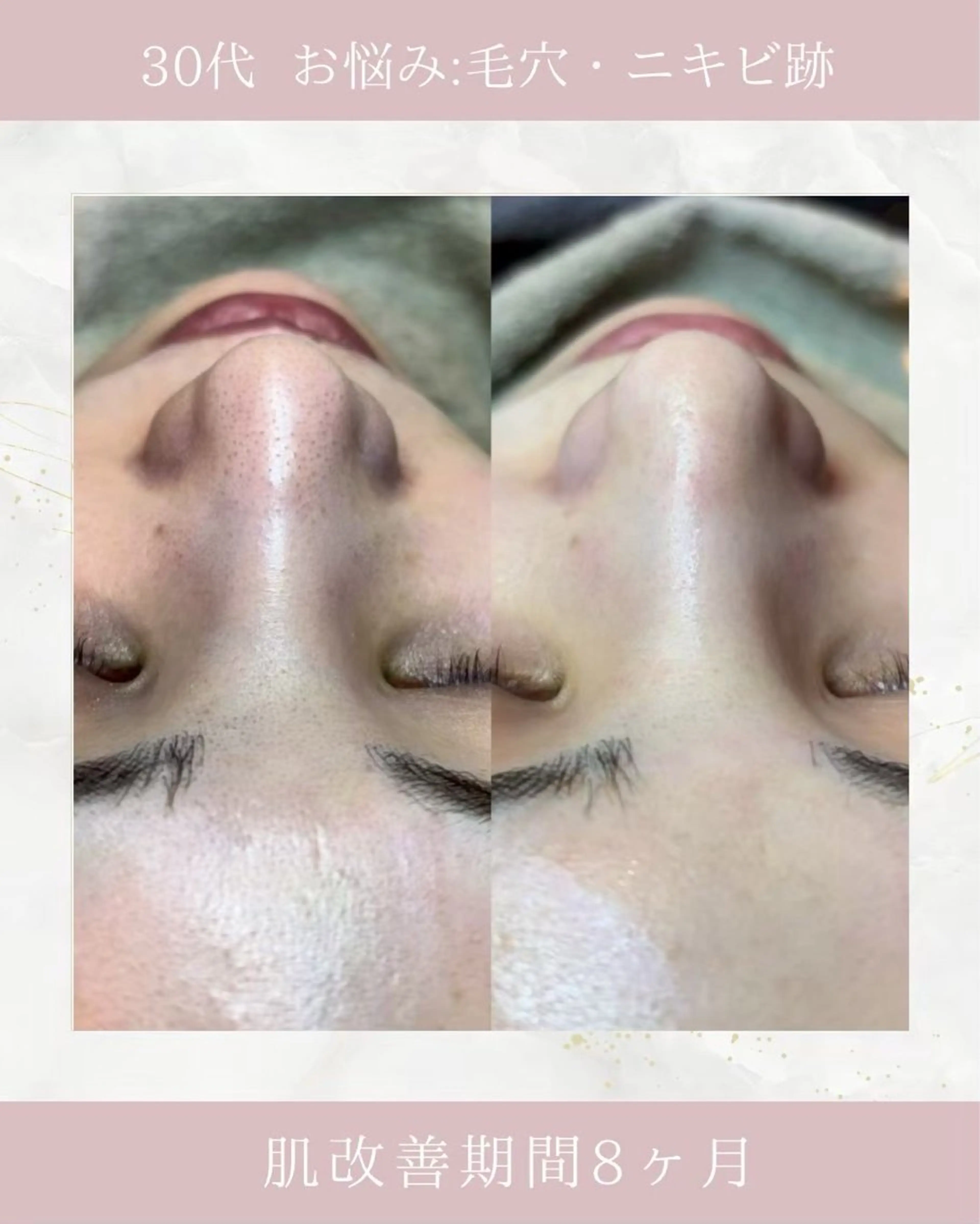 ARuru所属・ARuru 本店のエステ・リラクイメージ