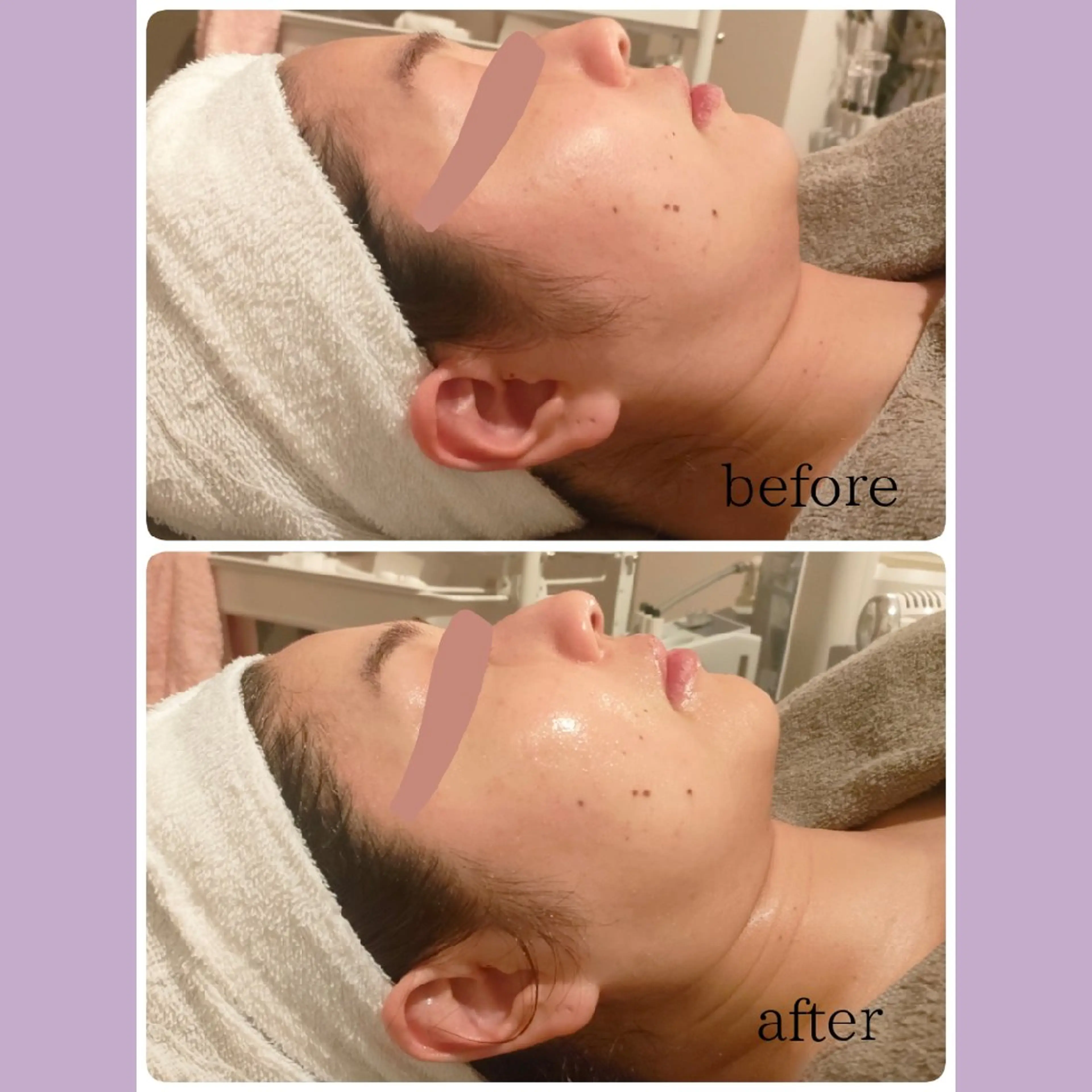 エステ Takeyama Kayonoのエステ・リラクイメージ