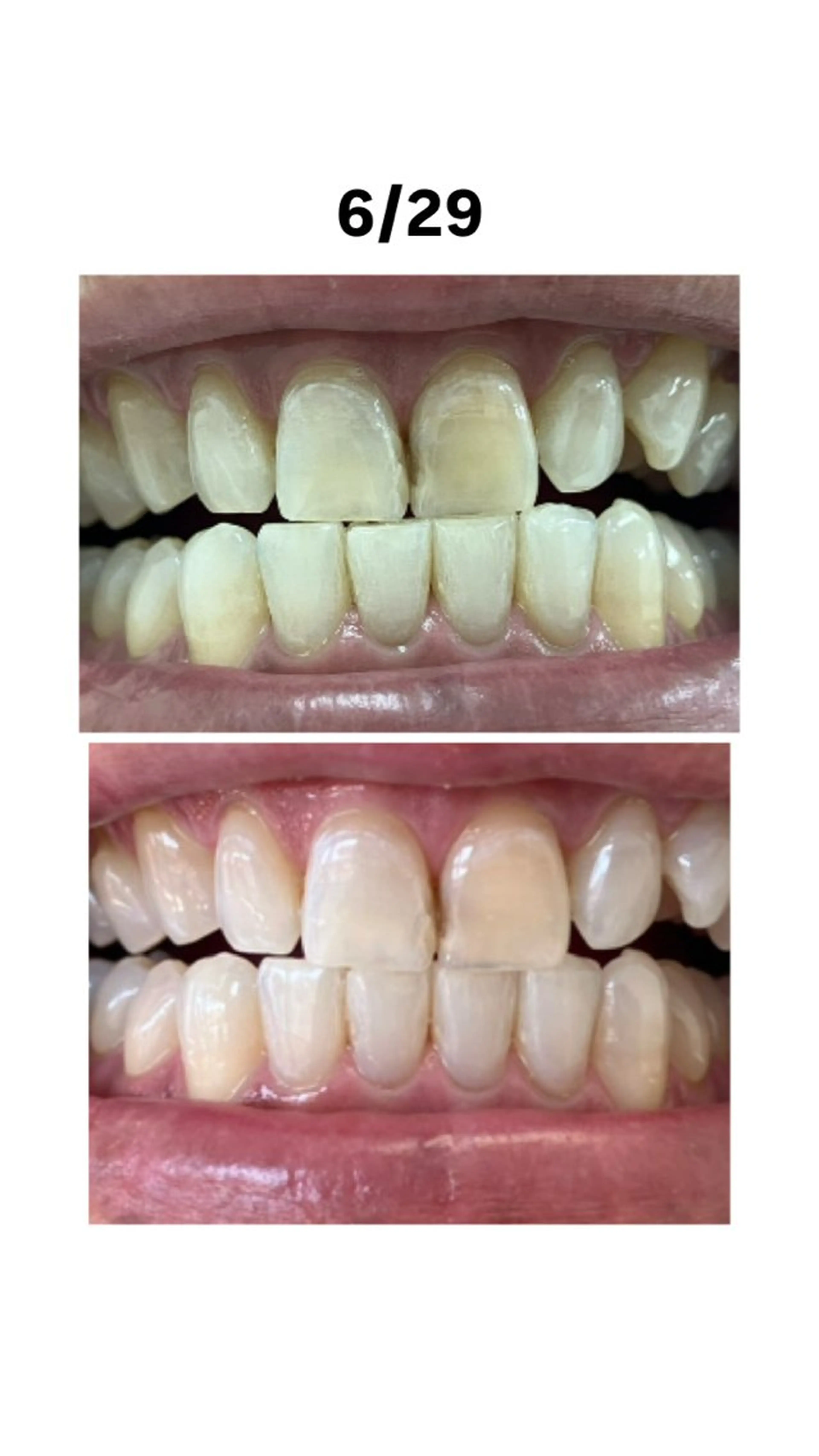 エステ リラク セルフホワイトニングサロンエクシアホワイト倉敷店所属・ecxiawhite 倉敷店のエステ・リラクイメージ