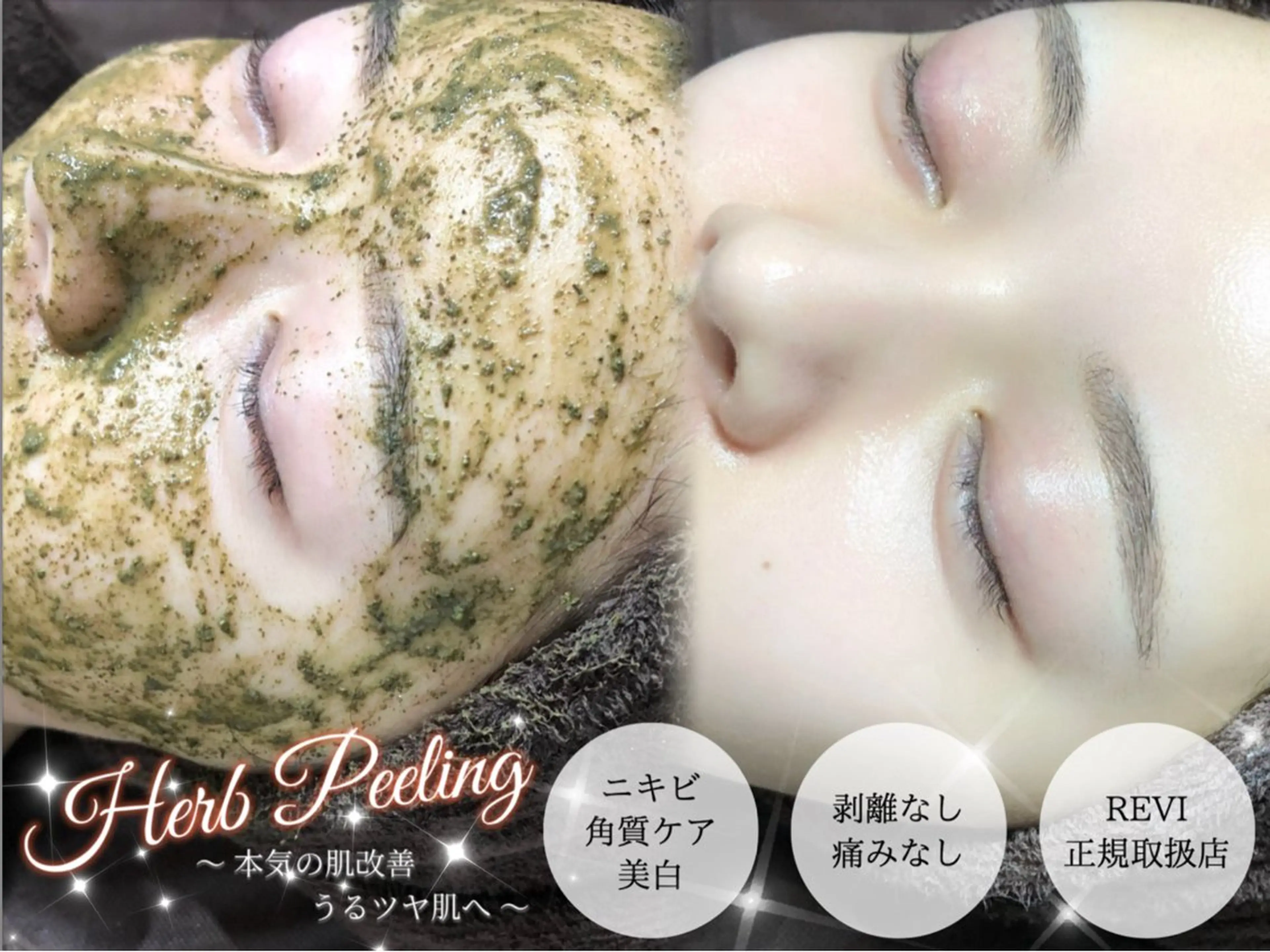 【REVI】ルヴィ　陶肌トリートメント　フェイシャル　ハーブピーリング ★オプション追加可能★　¥11000→¥8800の写真