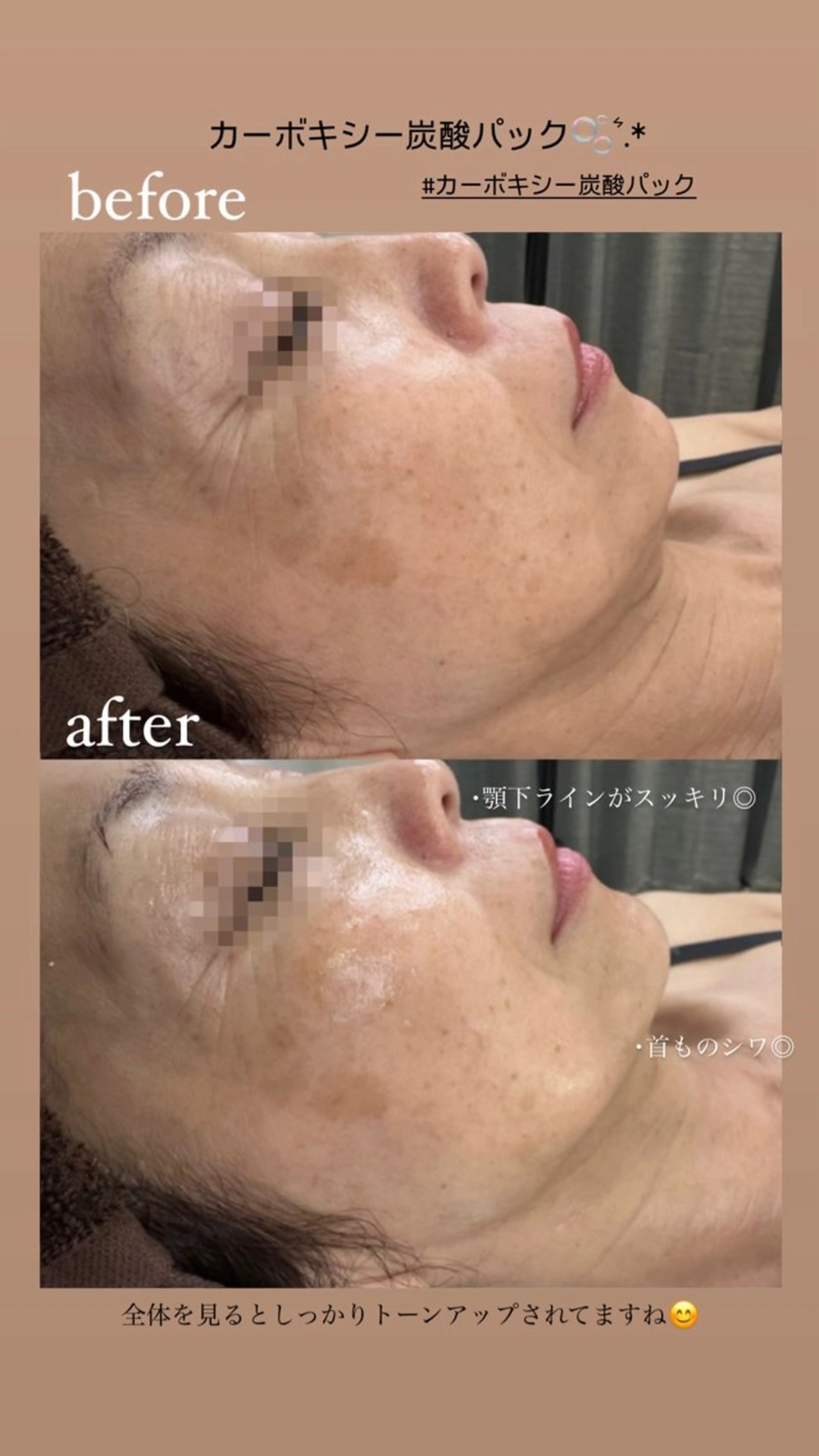 BIREINA Eyelash  Salon所属・BIREINA 住之江公園のマツエク・マツパデザイン