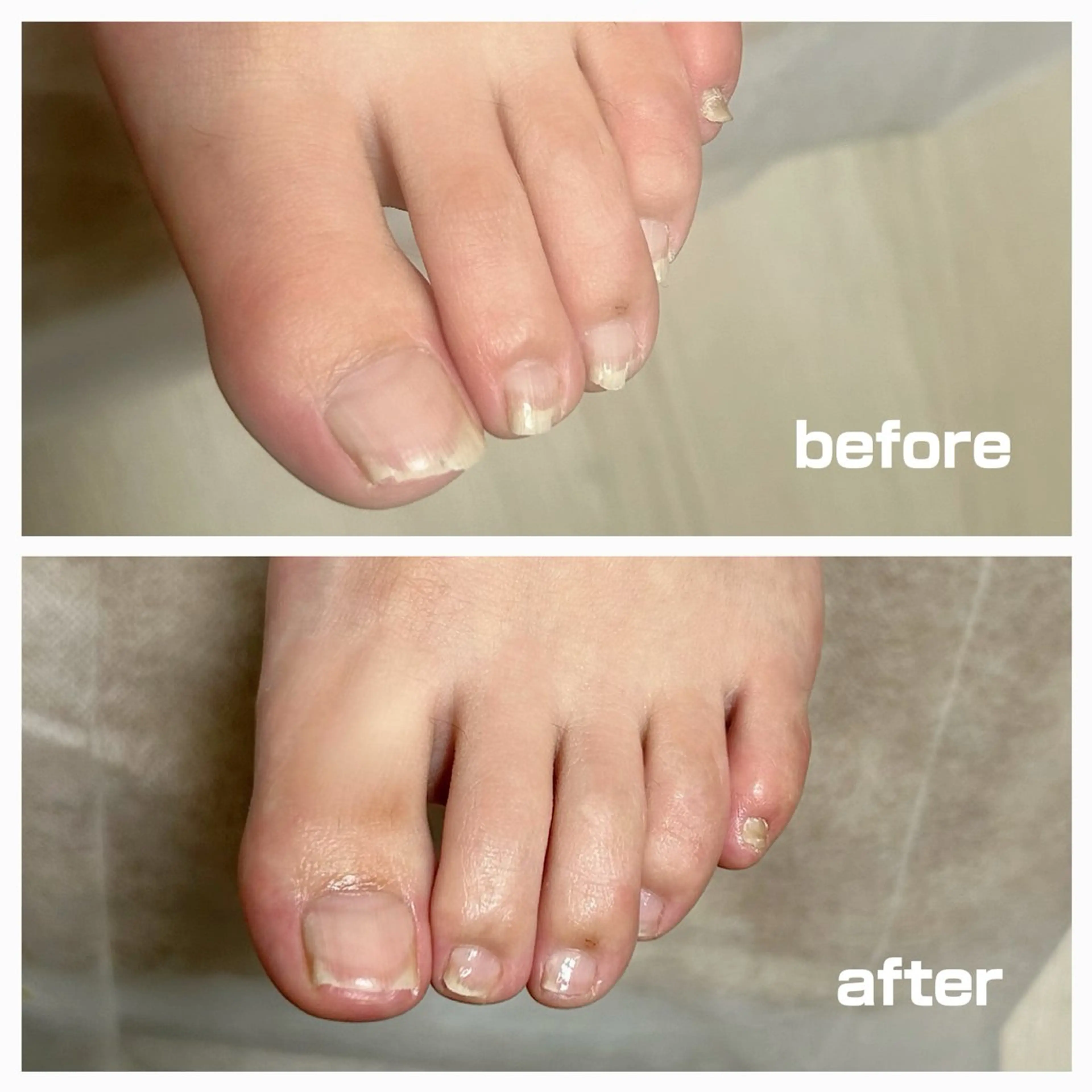 巻き爪フットケアサロンKotori所属・フットケアサロン Kotoriのその他イメージ