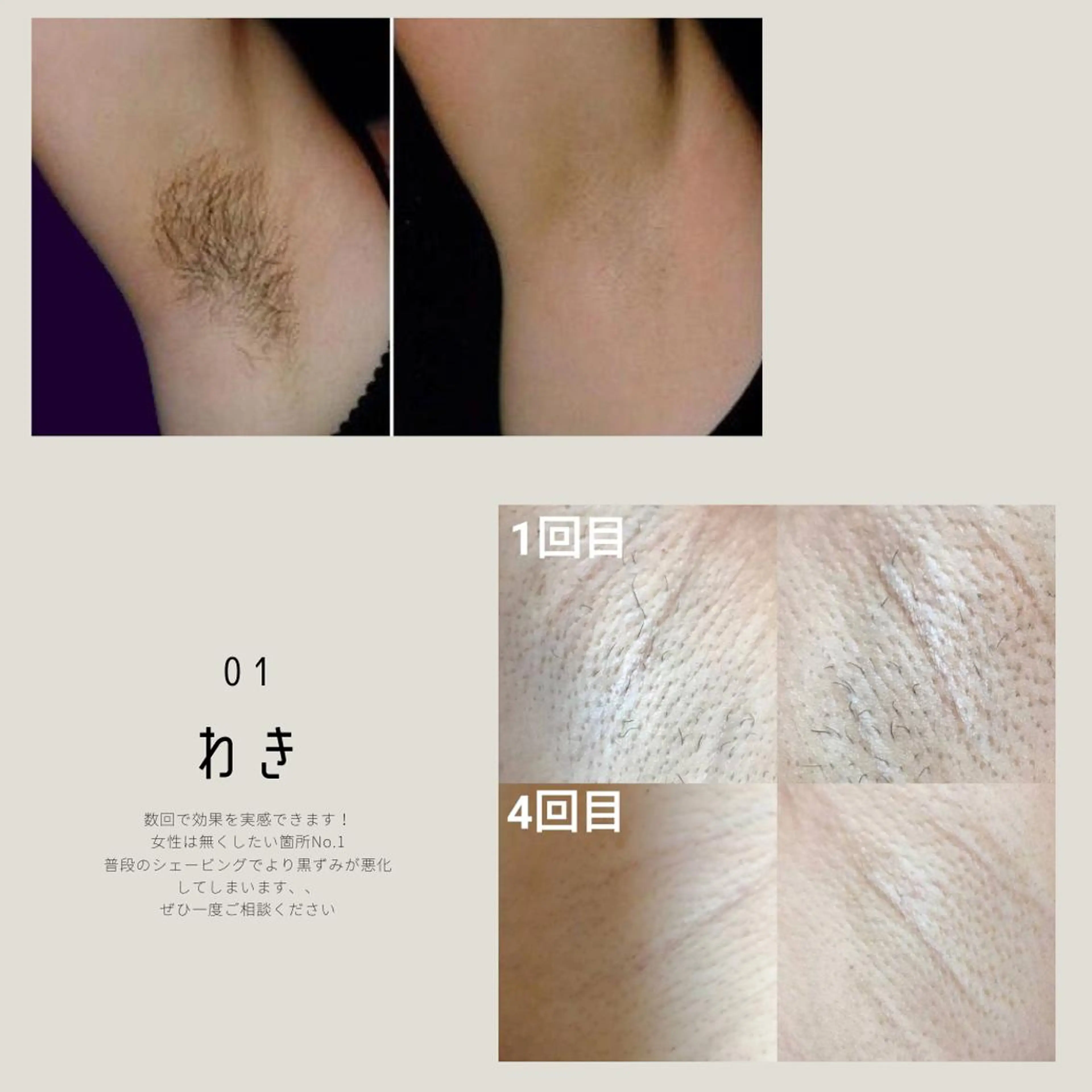 男女同額完全個室脱毛 LEPIA内田のエステ・リラクイメージ