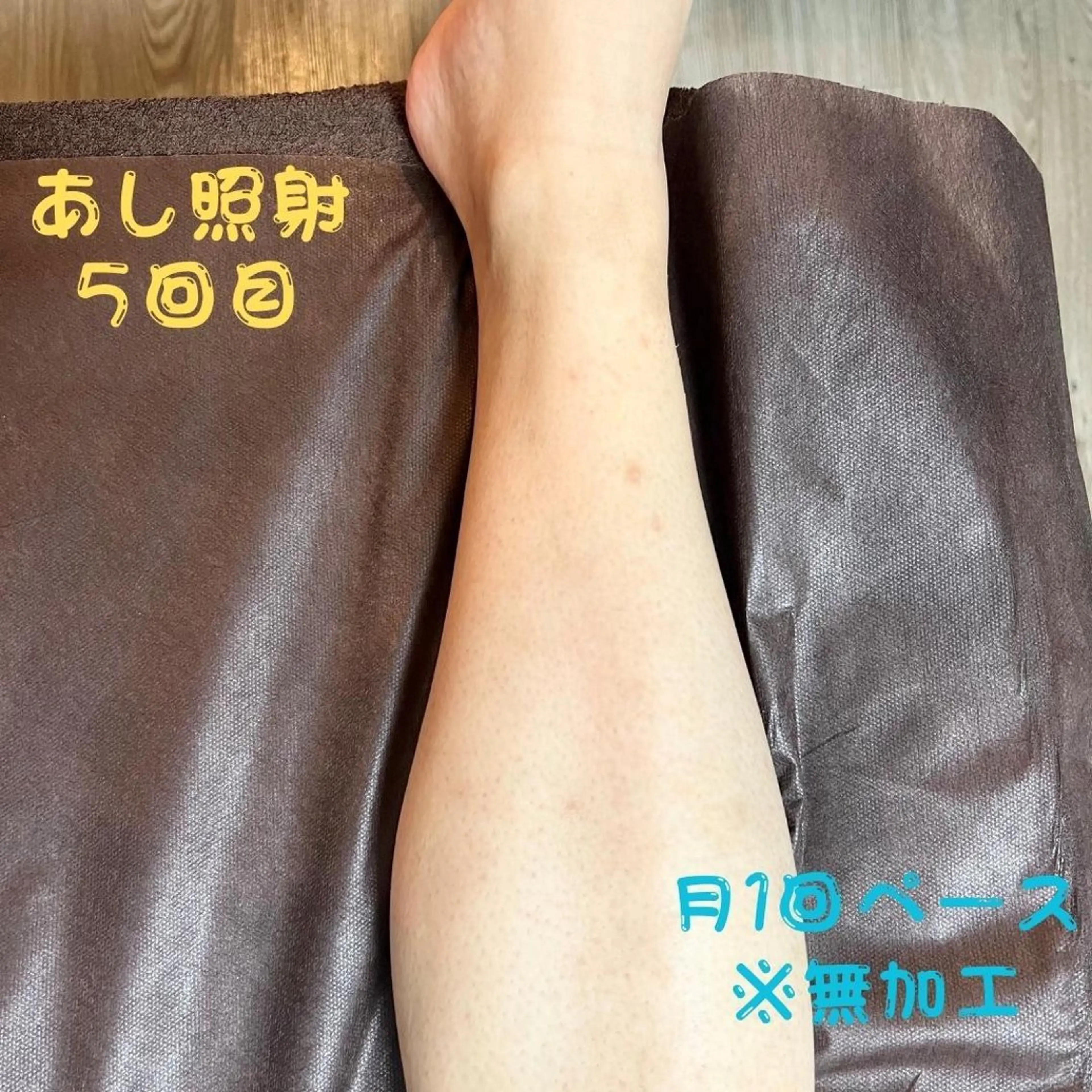 メンズ キッズ 脱毛 メンズ脱毛　FELISSE【フェリッセ】所属・メンズ脱毛フェリッセ /男女🆗キッズ🆗のエステ・リラクイメージ