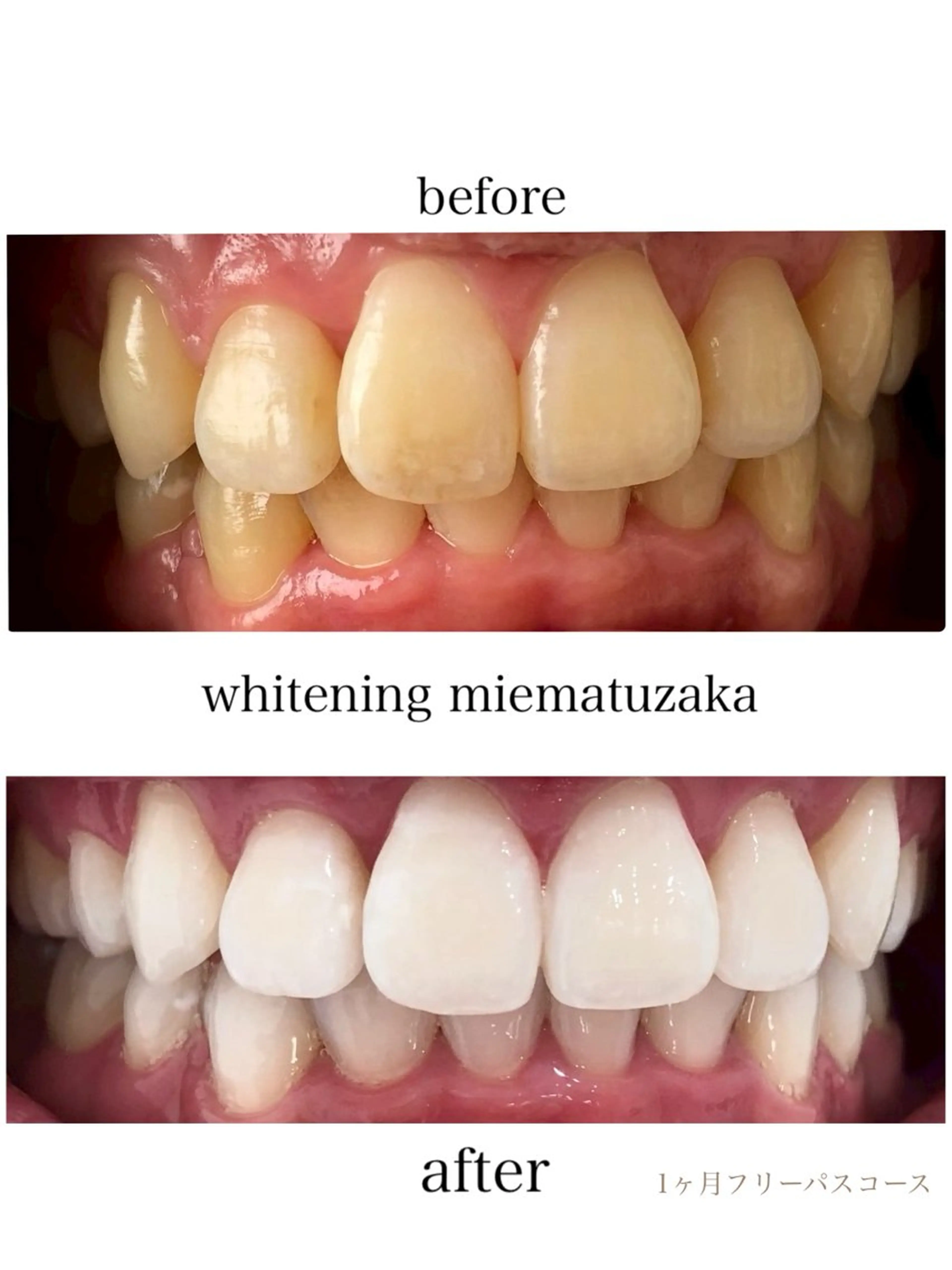 ホワイトニングショップ三重松阪店所属・ホワイトニング ショップ三重松阪店のその他イメージ