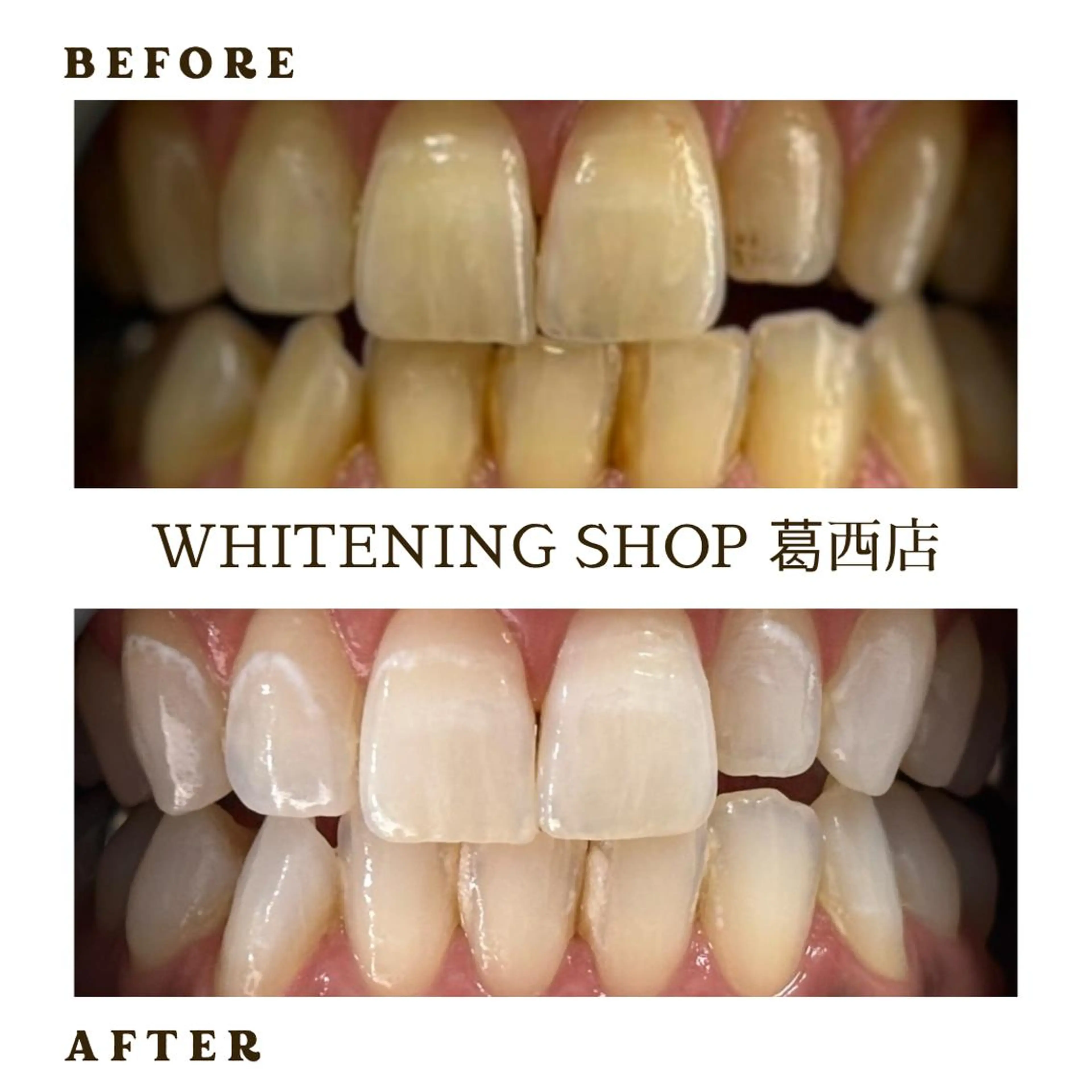 メンズ その他 ホワイトニング ショップ葛西店のその他イメージ