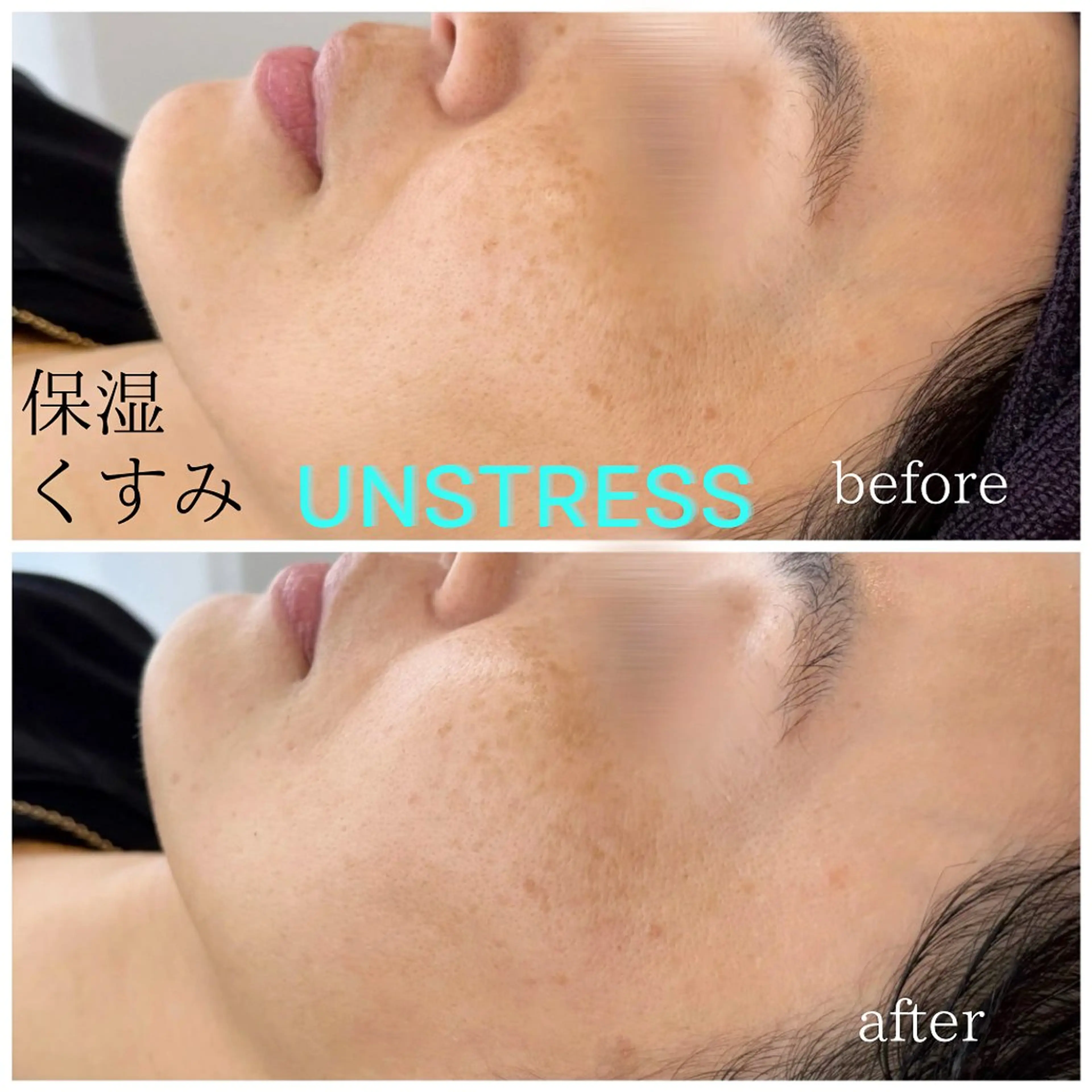 エステ écla【中崎町】 yukikoのエステ・リラクイメージ