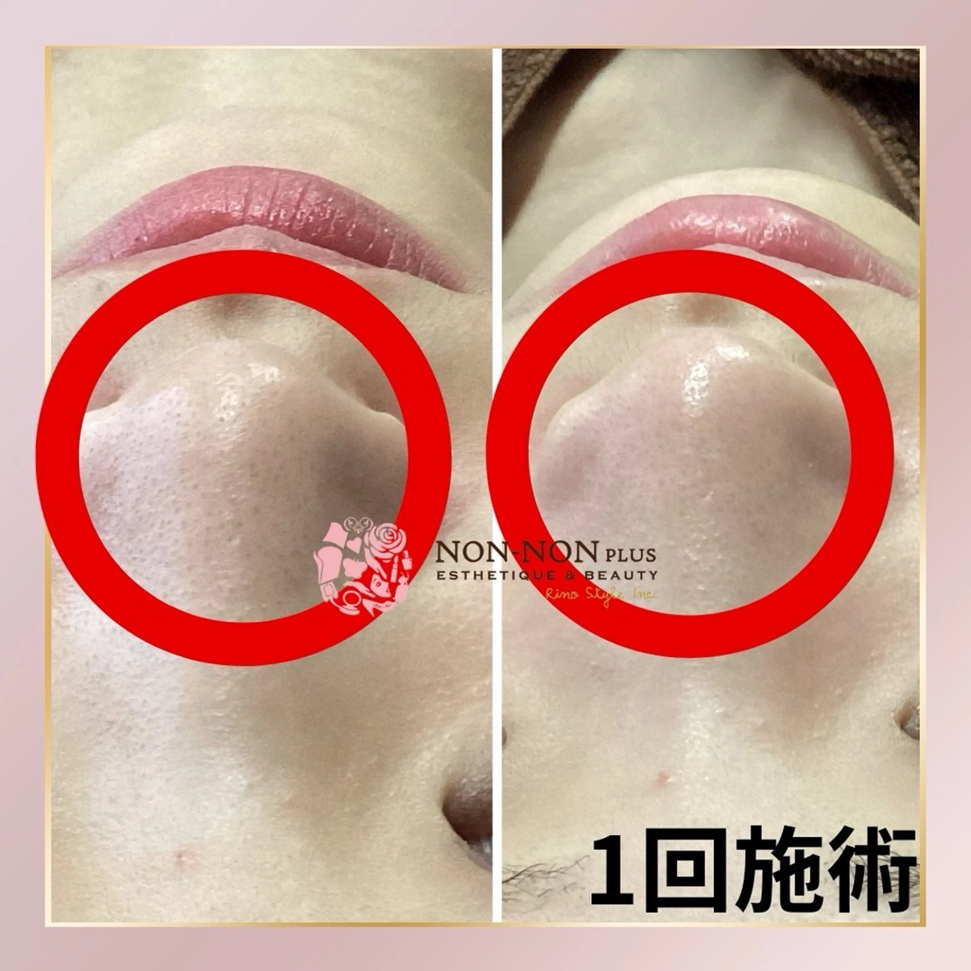 NON-NONプラス 大人の本気痩身のエステ・リラクイメージ