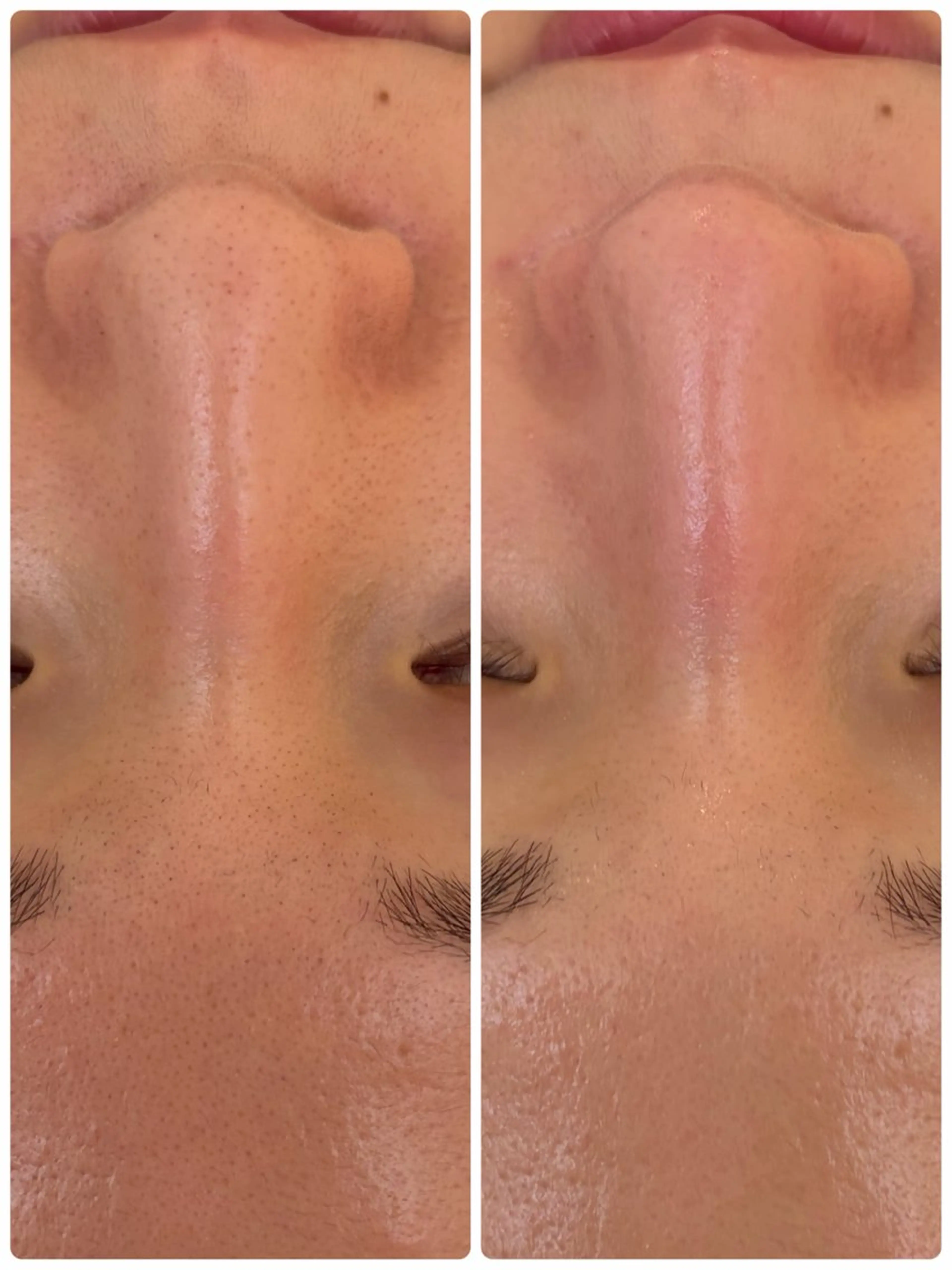 beauty salon Clochette所属・clochette misakoのエステ・リラクイメージ