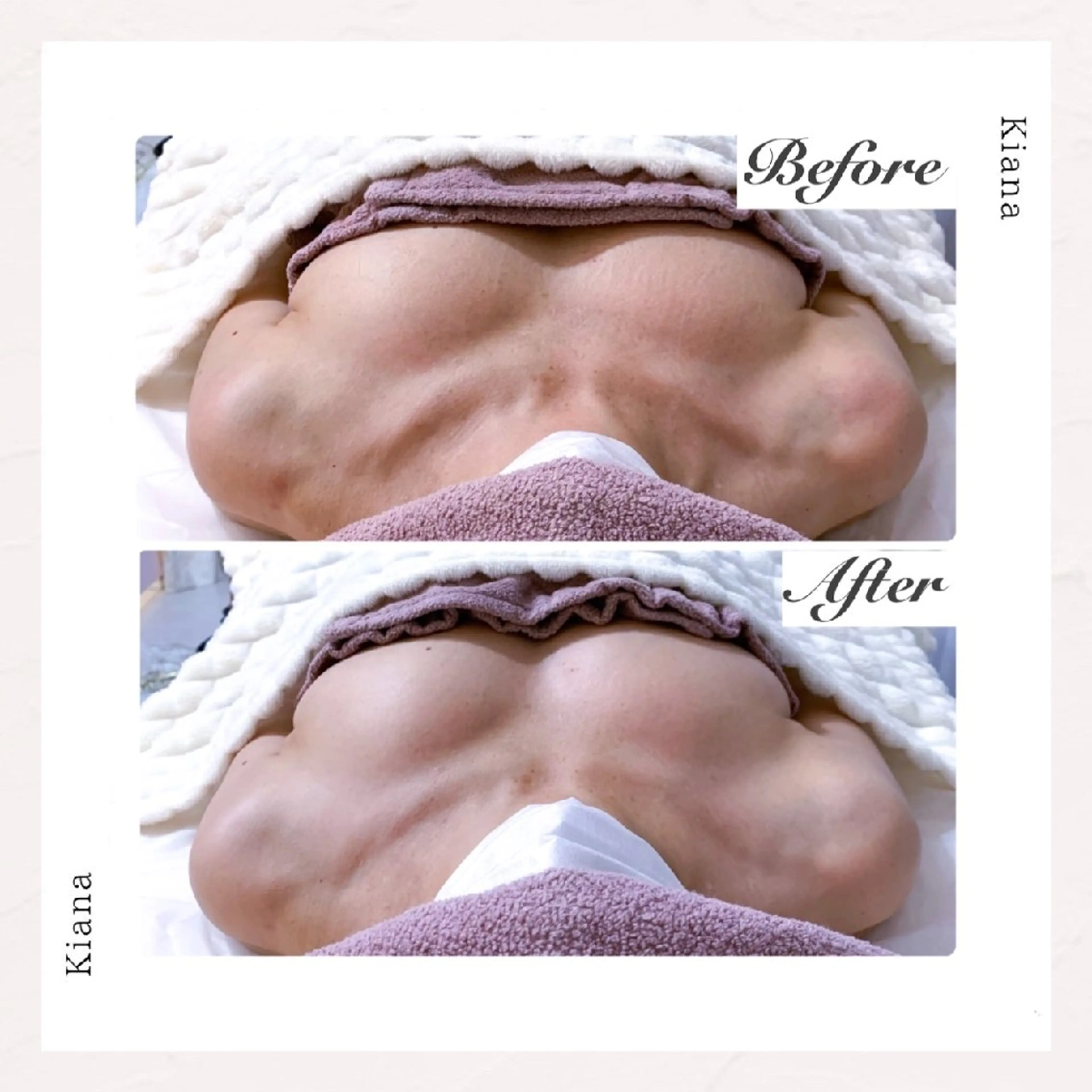 【バスト専門店 】 Kiana のエステ・リラクイメージ