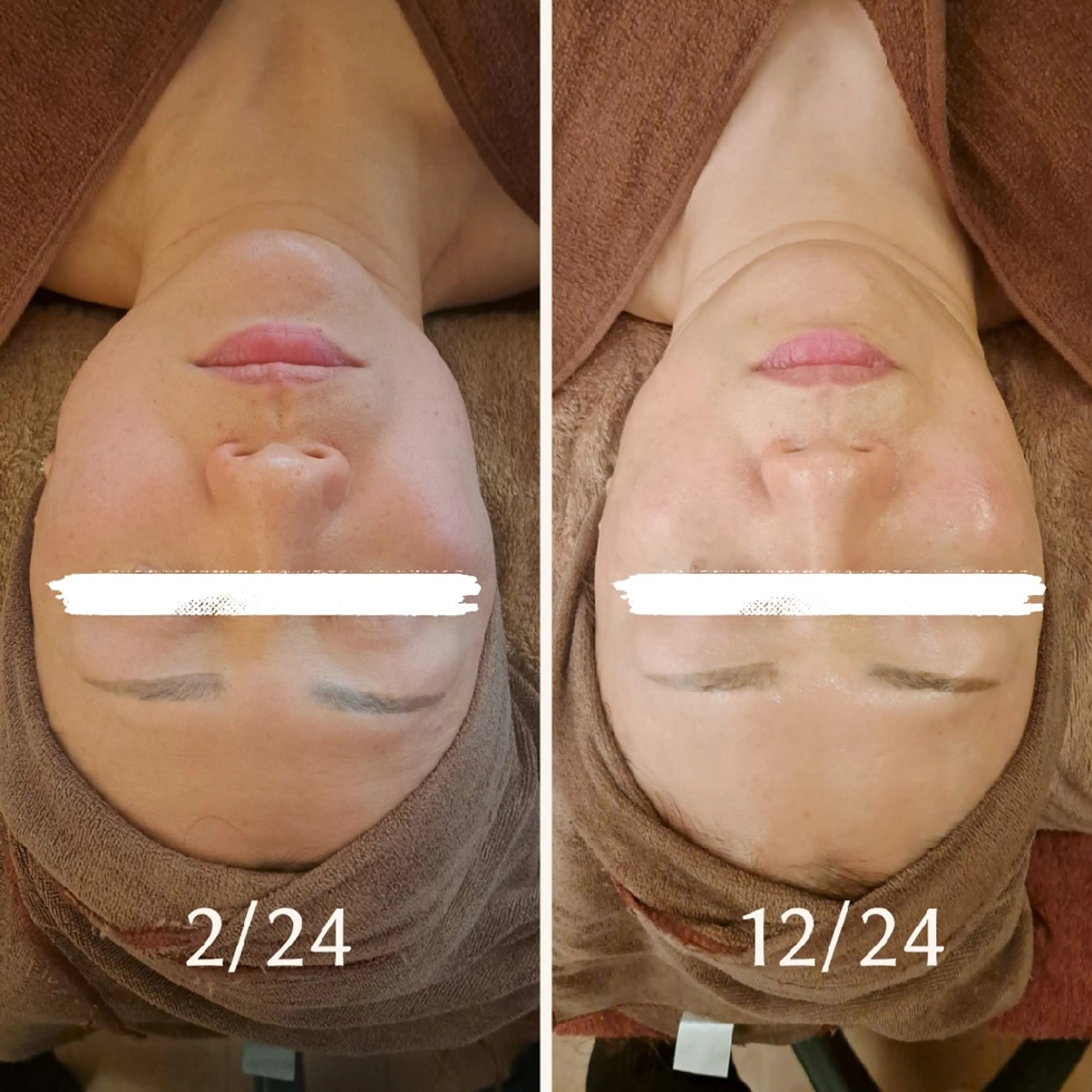 エステ リラク 鍼灸サロンmiyabi所属・美容鍼×エステ　鍼灸 サロンmiyabiのエステ・リラクイメージ