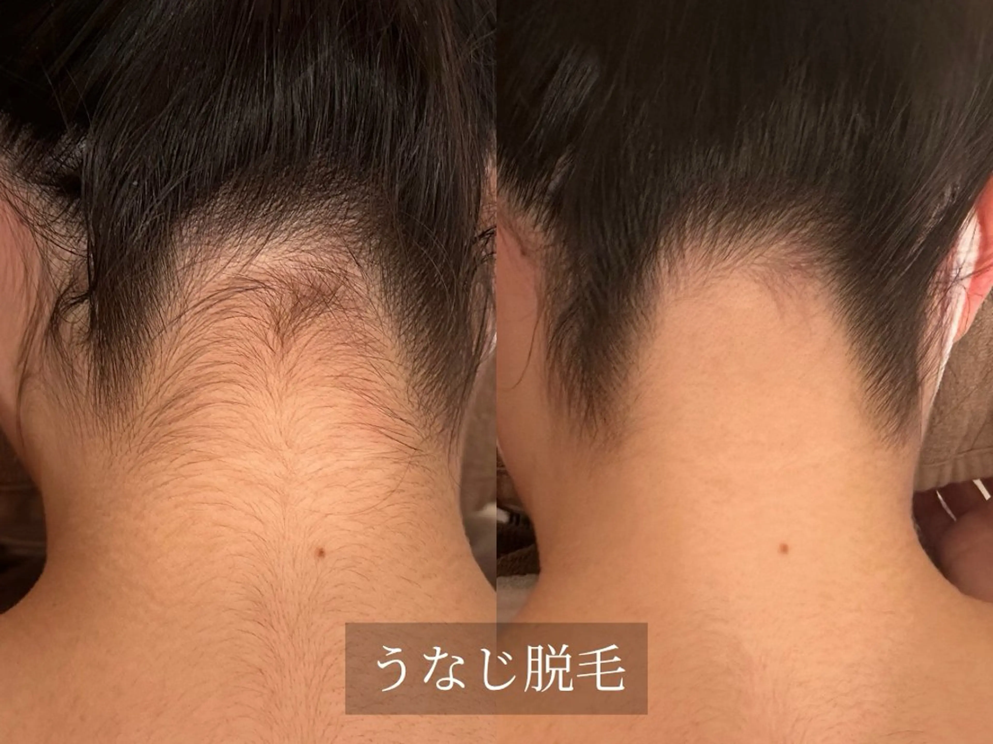 プライベート脱毛サロン　Arum所属・脱毛サロン Arumのエステ・リラクイメージ