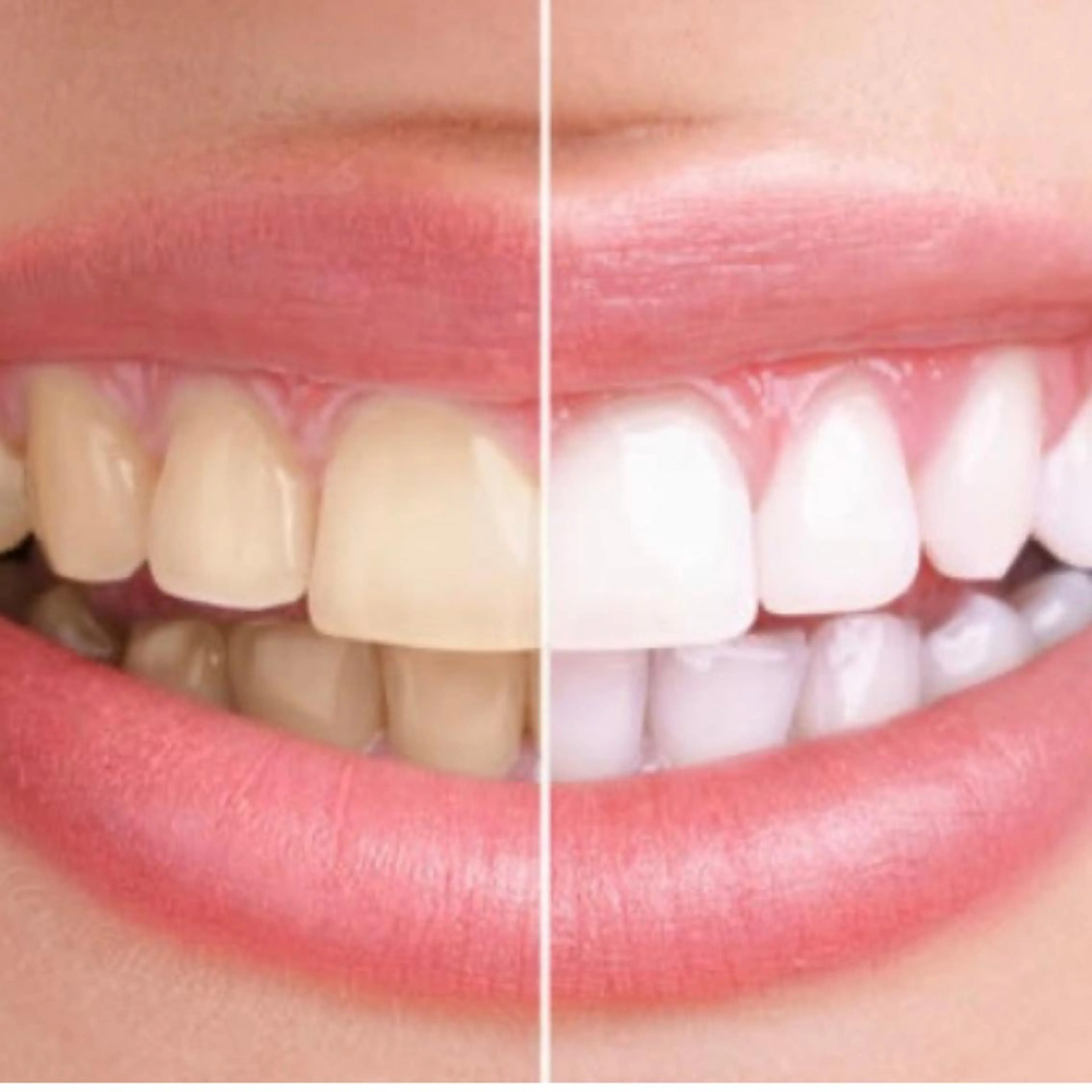 N.BODY  のエステ・リラクイメージ