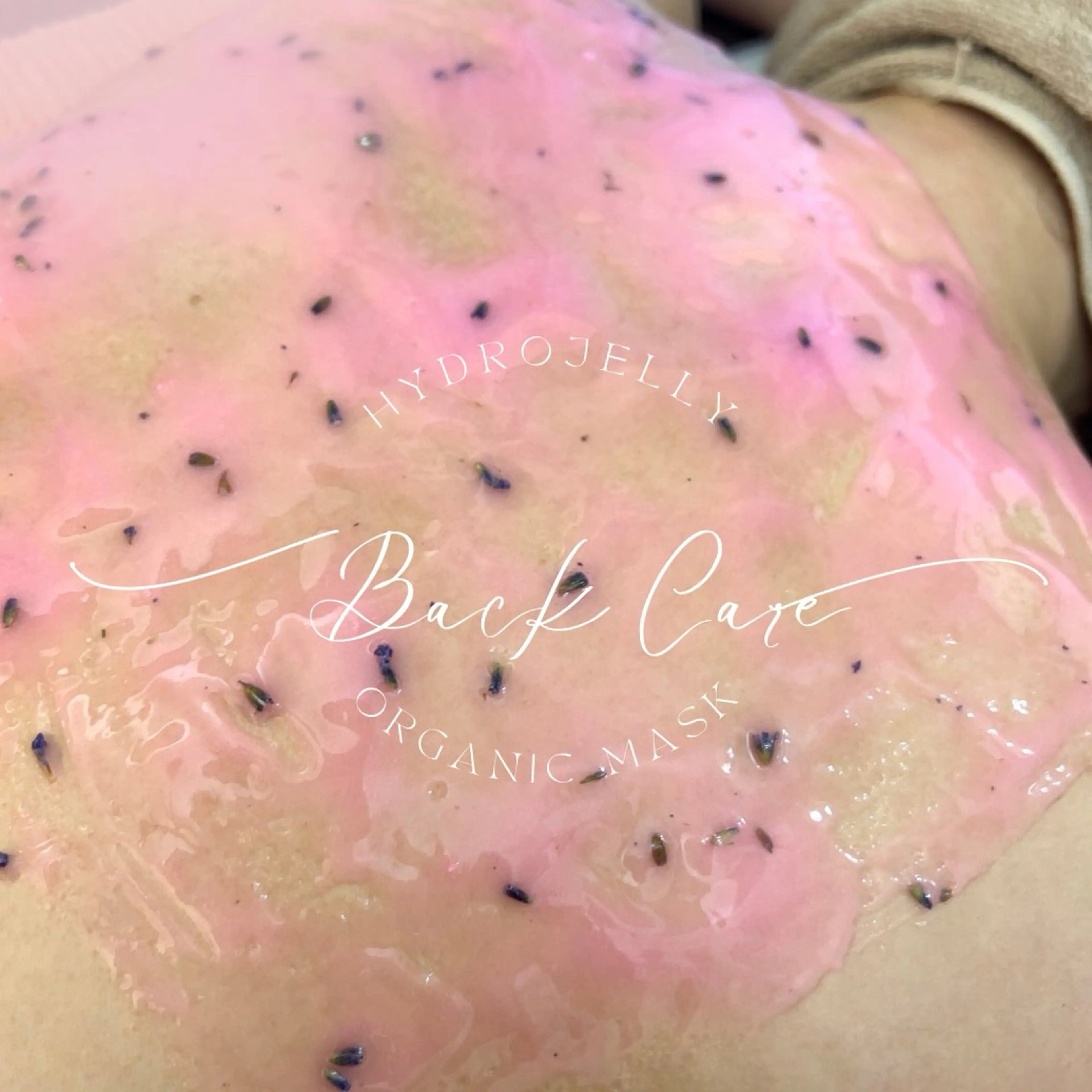 背中ワックス脱毛＋美白パックの写真