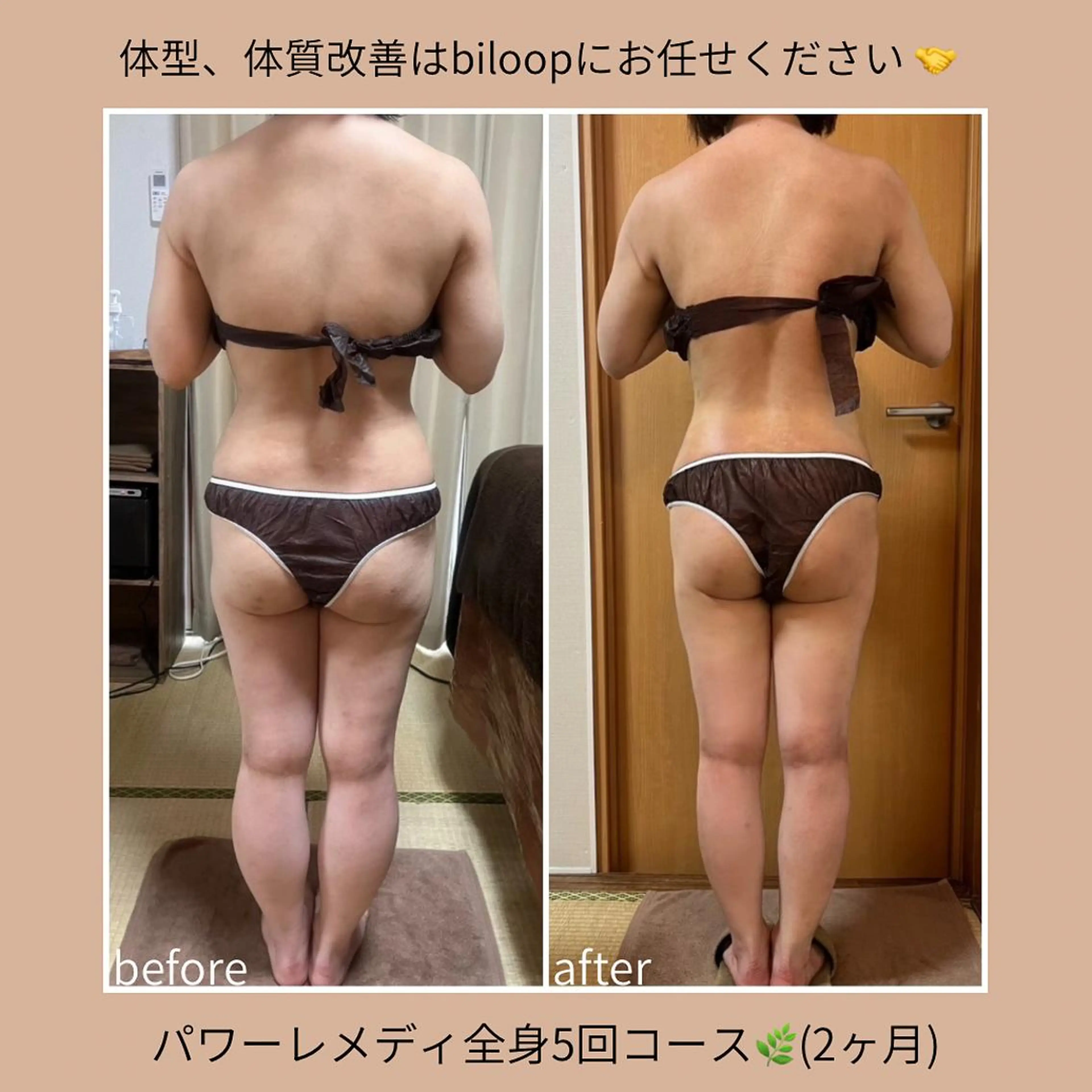 biloop所属・《本気痩せ×疲労改善 》 BILOOPのエステ・リラクイメージ