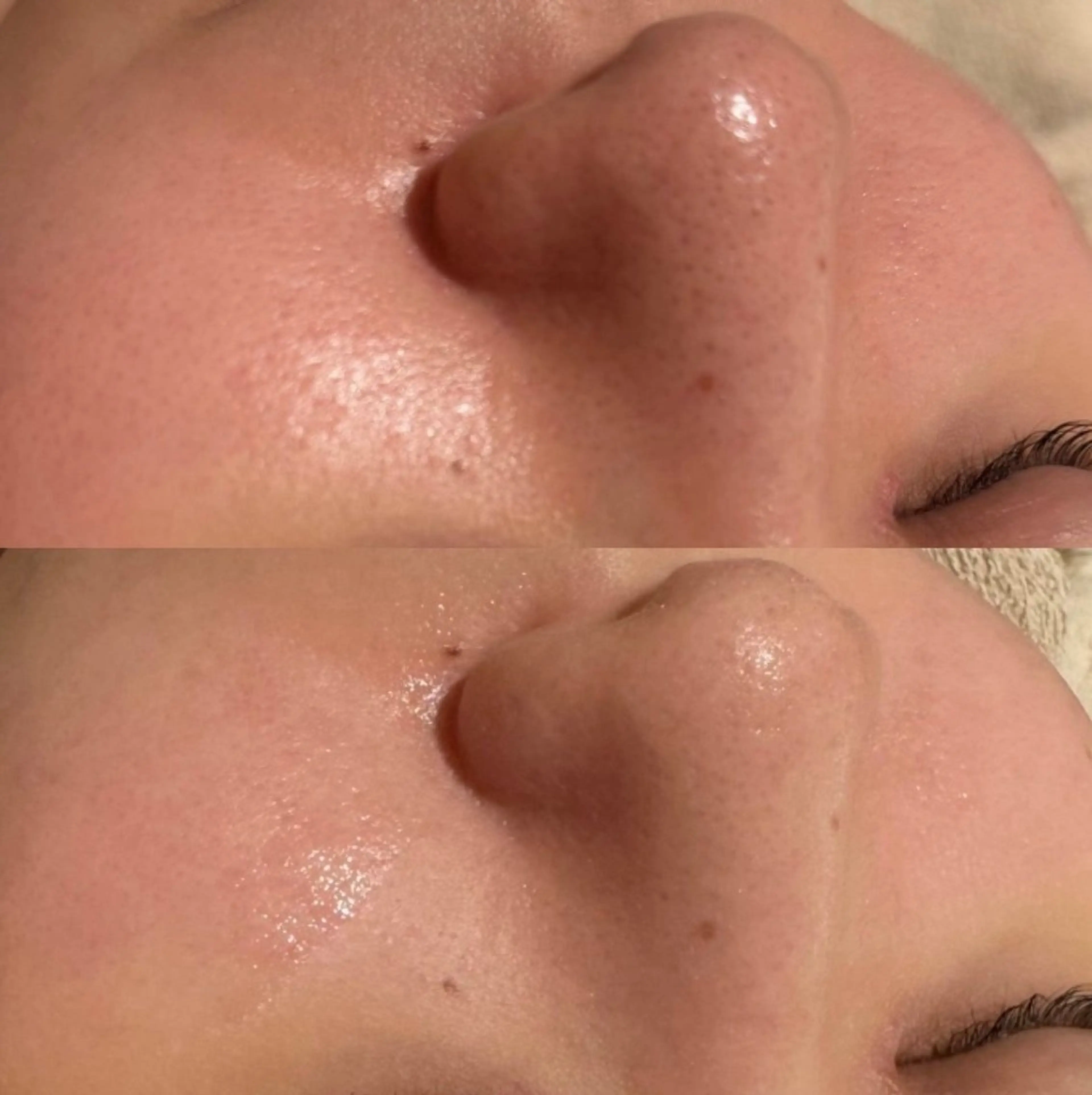 その他 for woman所属・森 美優のエステ・リラクイメージ