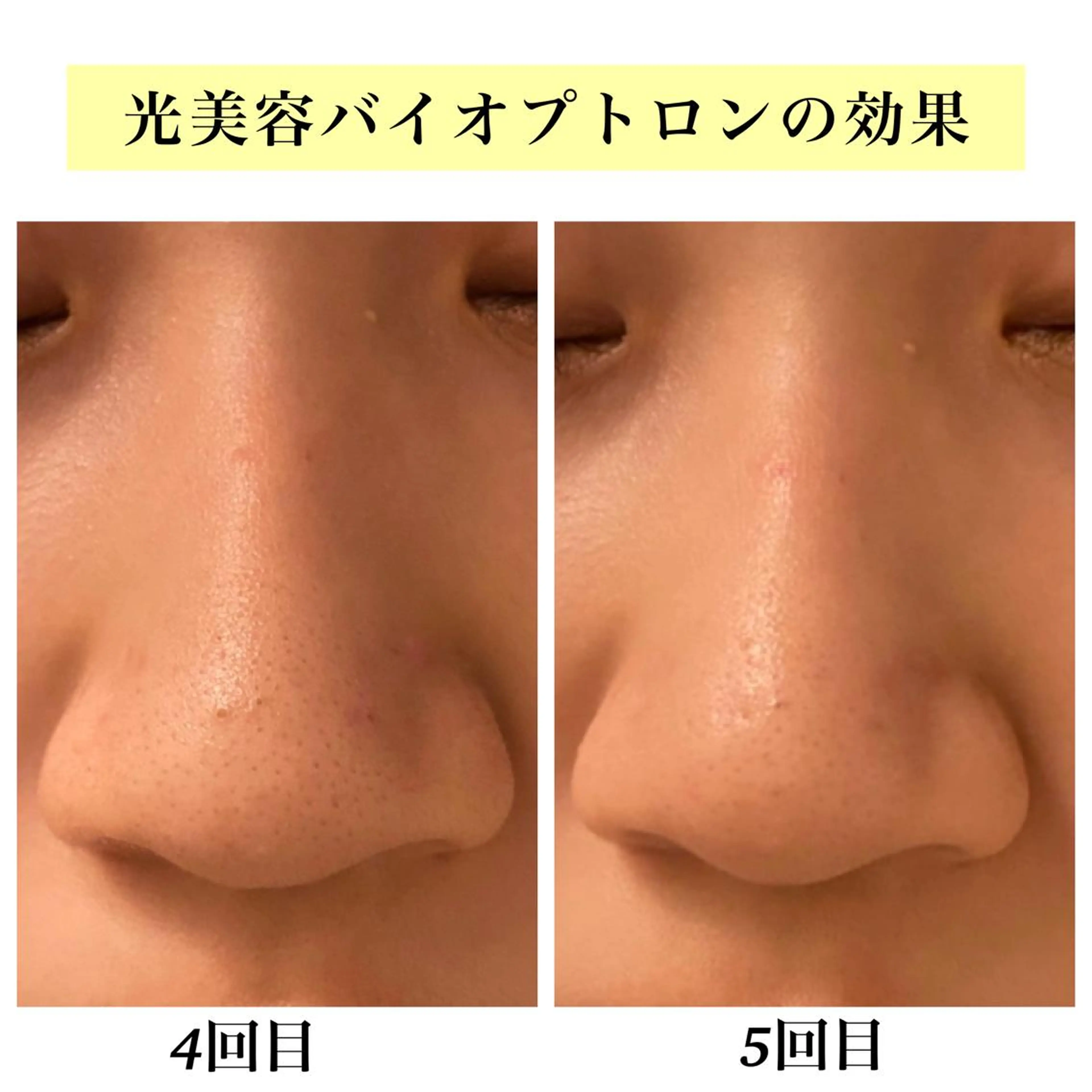 Bellesthe （ベルエステ）のエステ・リラクイメージ