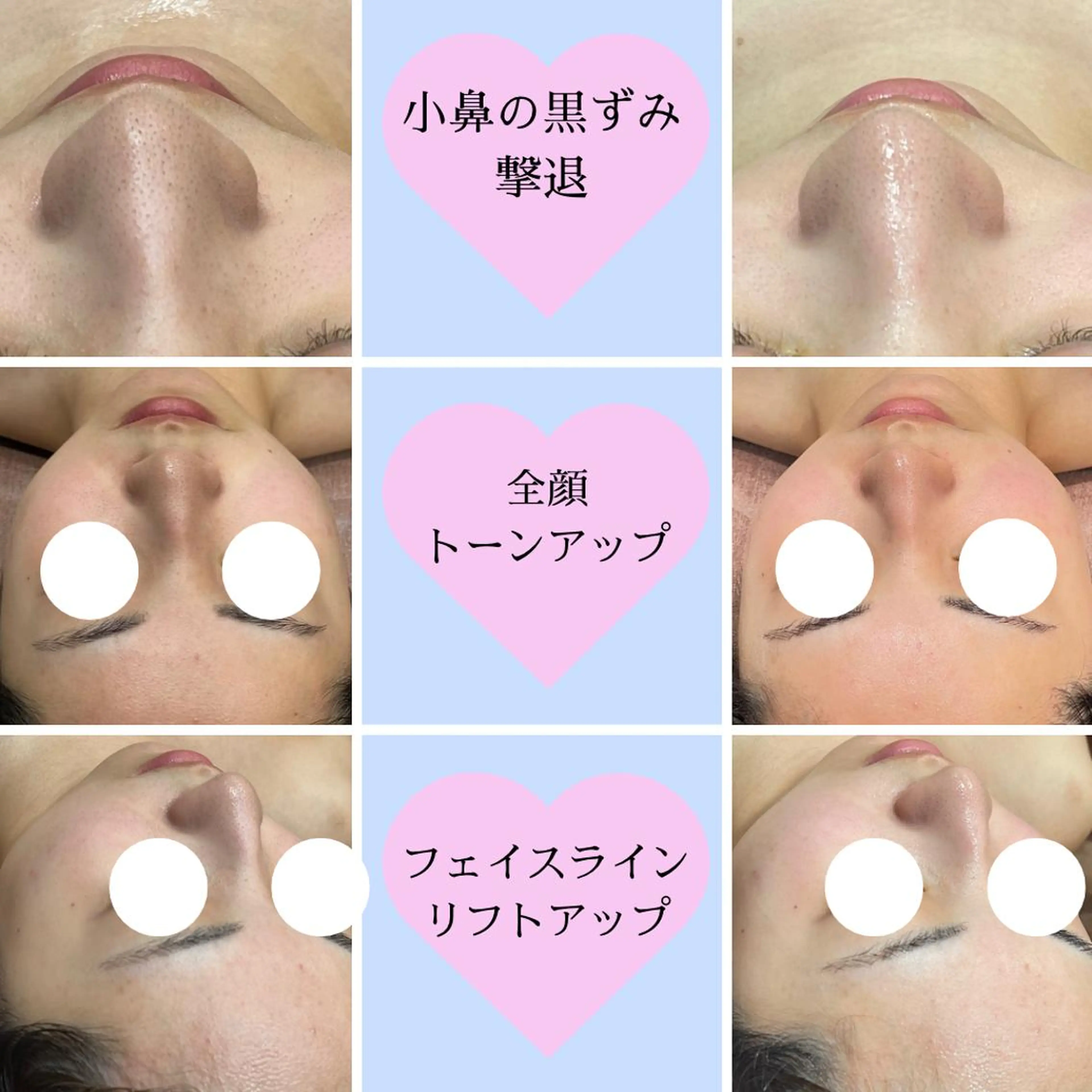 🎀美肌サロン レイビス川崎店🎀のエステ・リラクイメージ