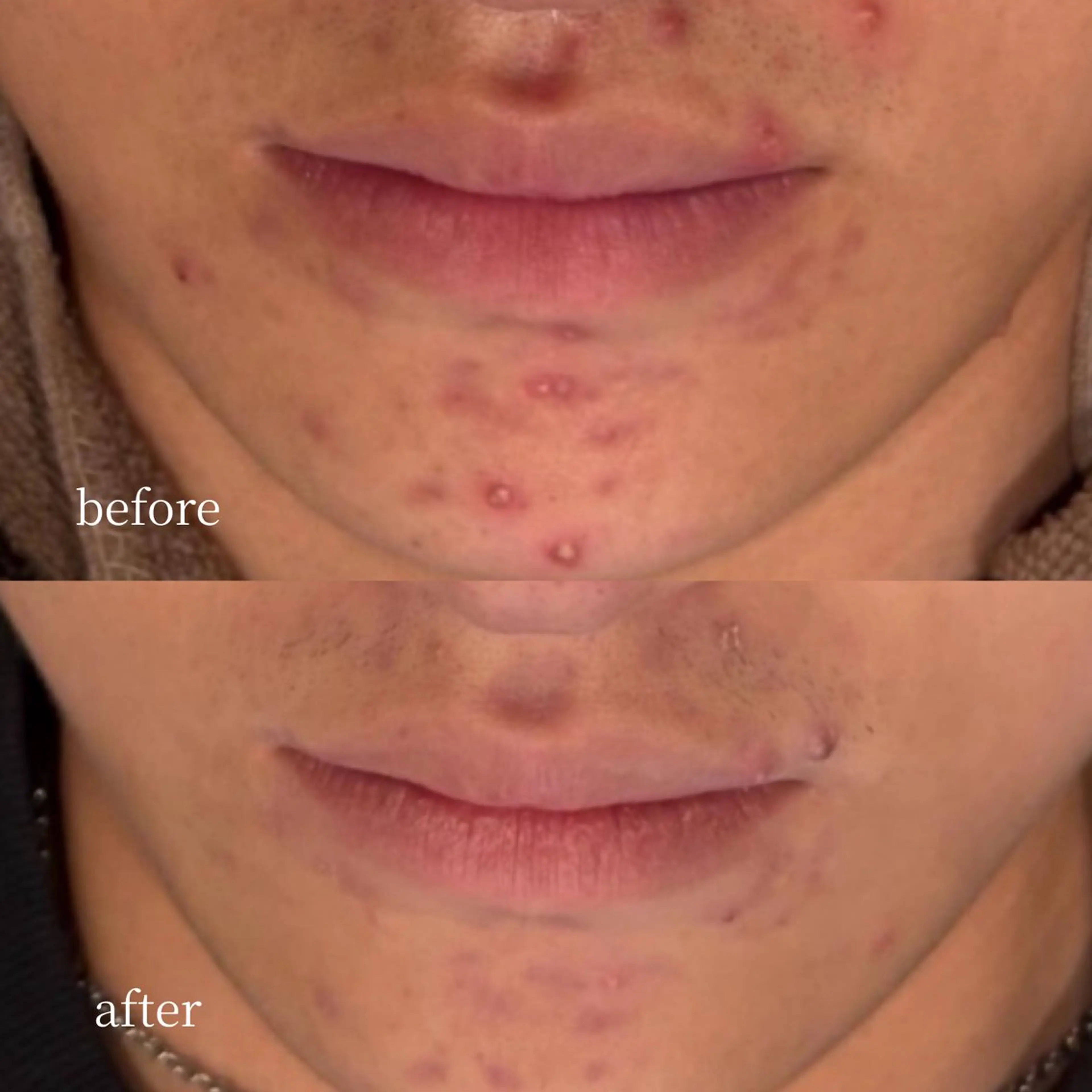 エステ 韓国肌管理・肌質改善 EARNEST心斎橋のエステ・リラクイメージ