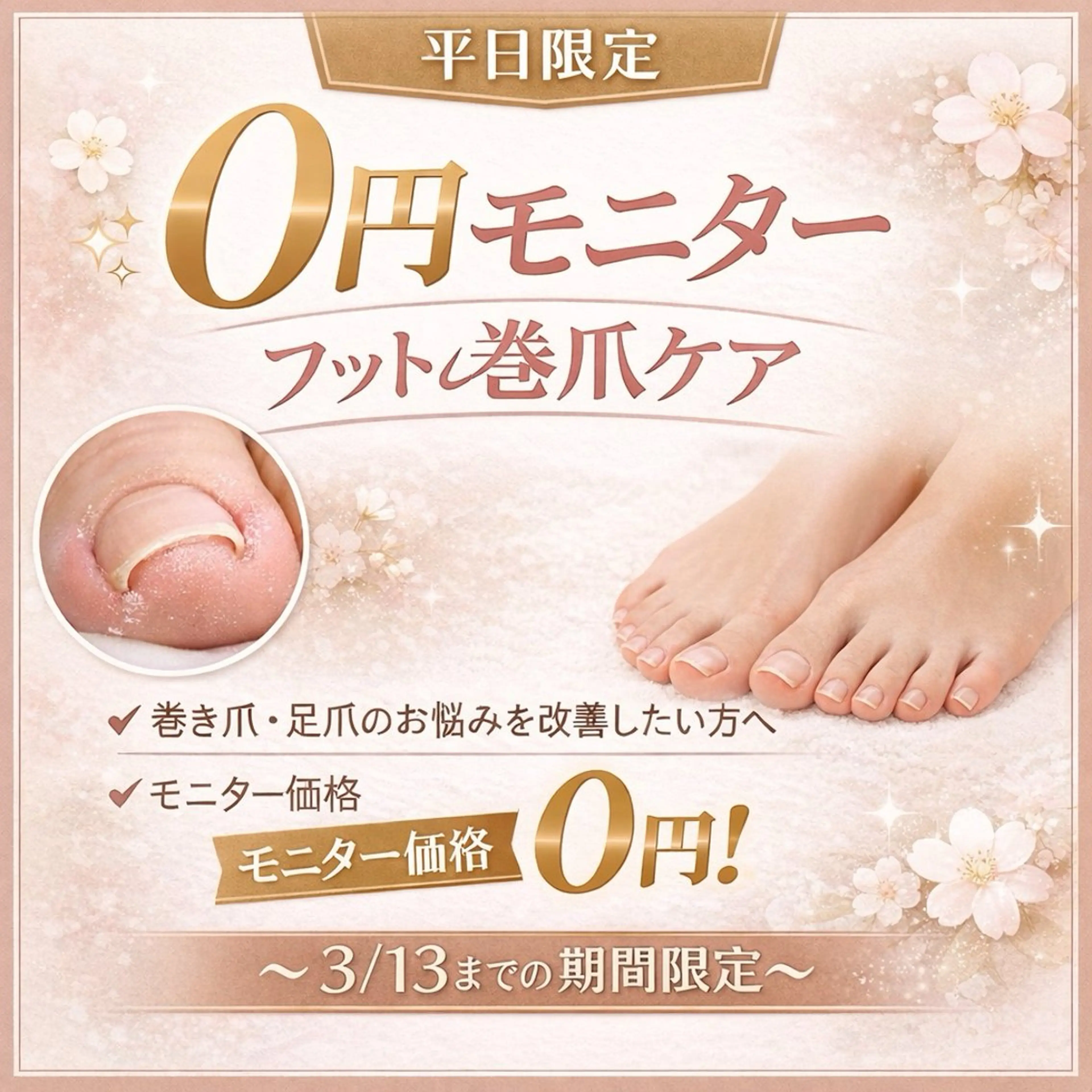 【モニター】巻爪ケア👣⸒⸒注意事項をお読みくださいの写真