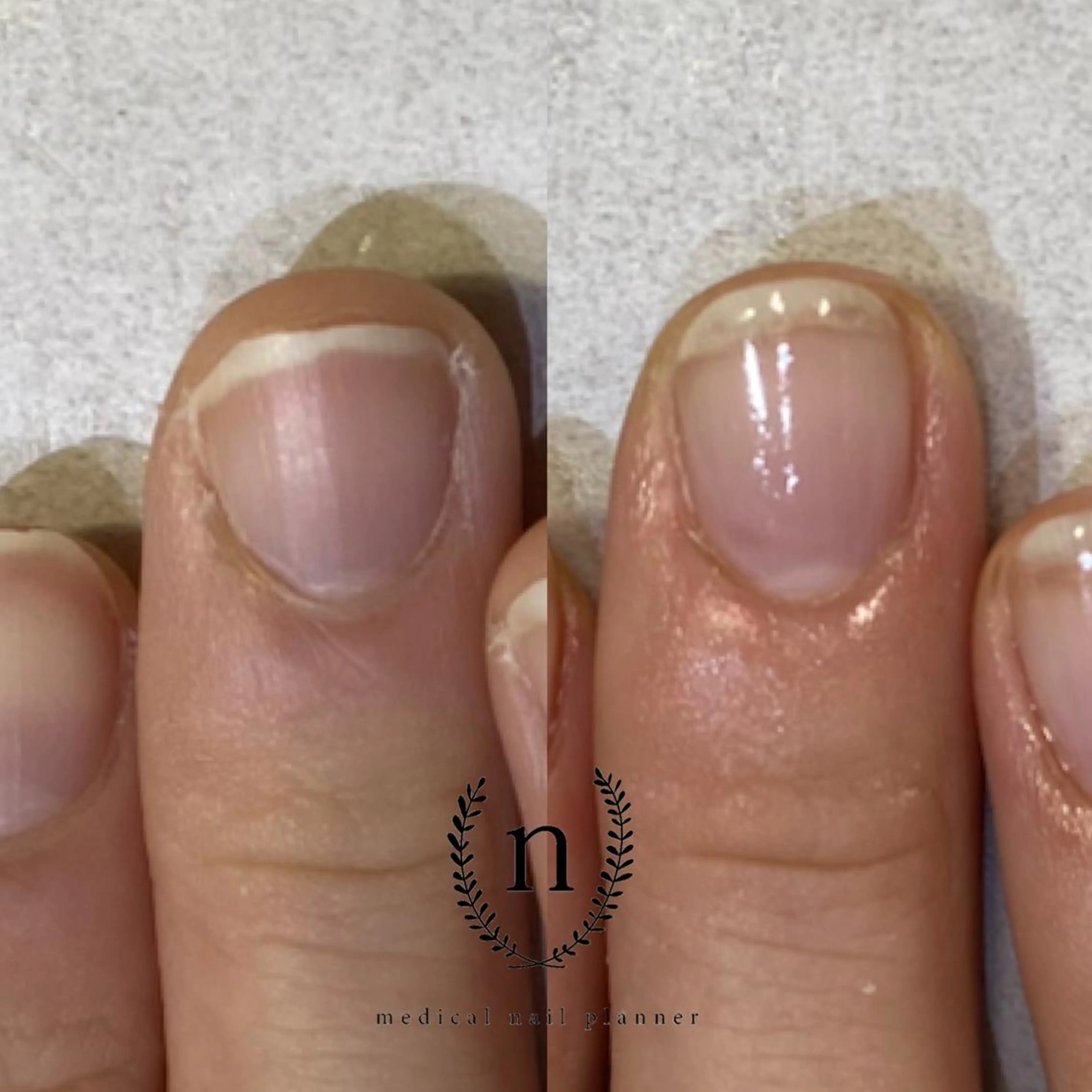 ネイル Rio 𓍼のネイルデザイン