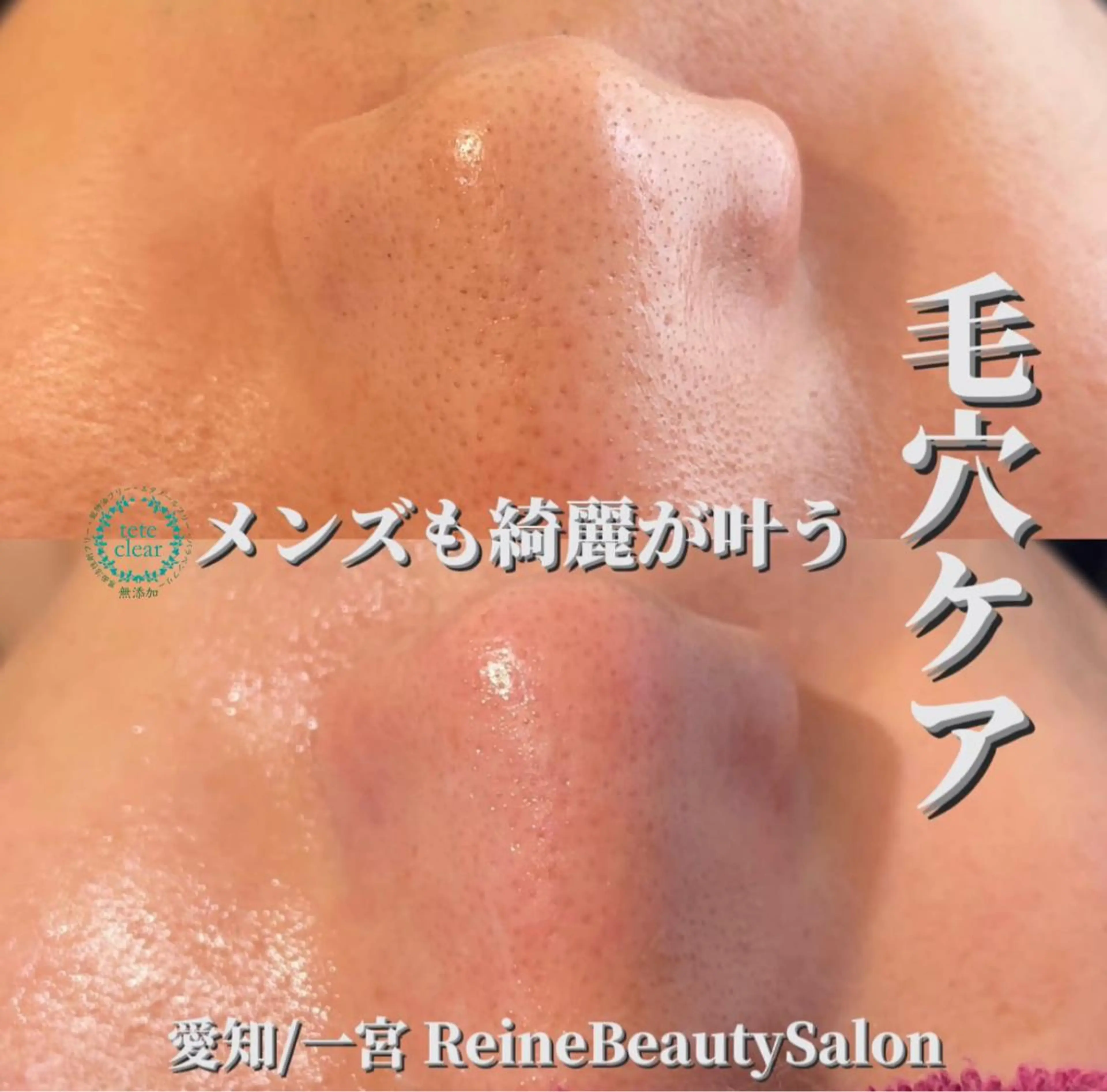 エステ Reine BeautySalon所属・毛穴/シミ肝斑/脱毛 横山梨里のエステ・リラクイメージ