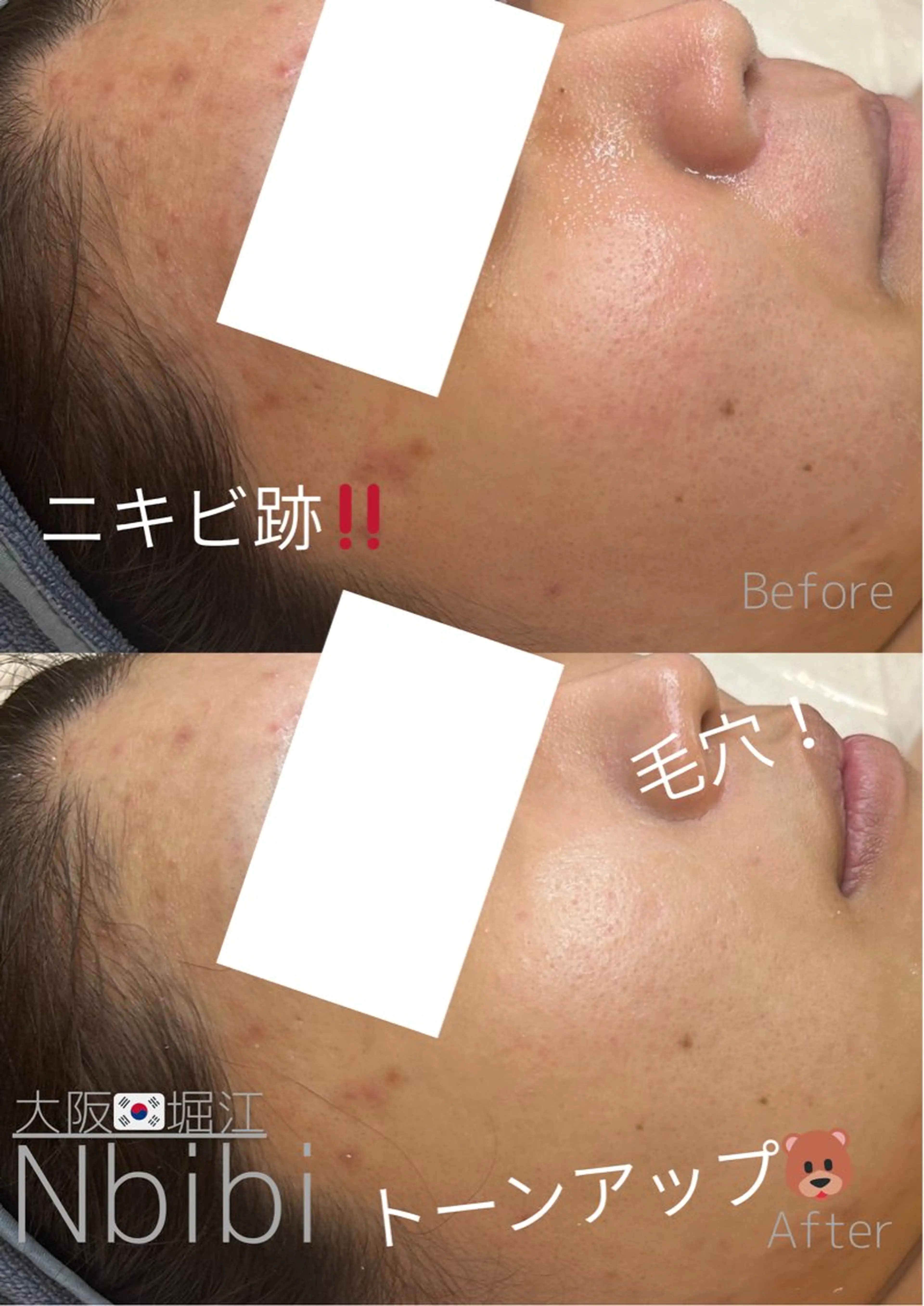 エステ 韓国🇰🇷価格 サロン_Nbibiのエステ・リラクイメージ