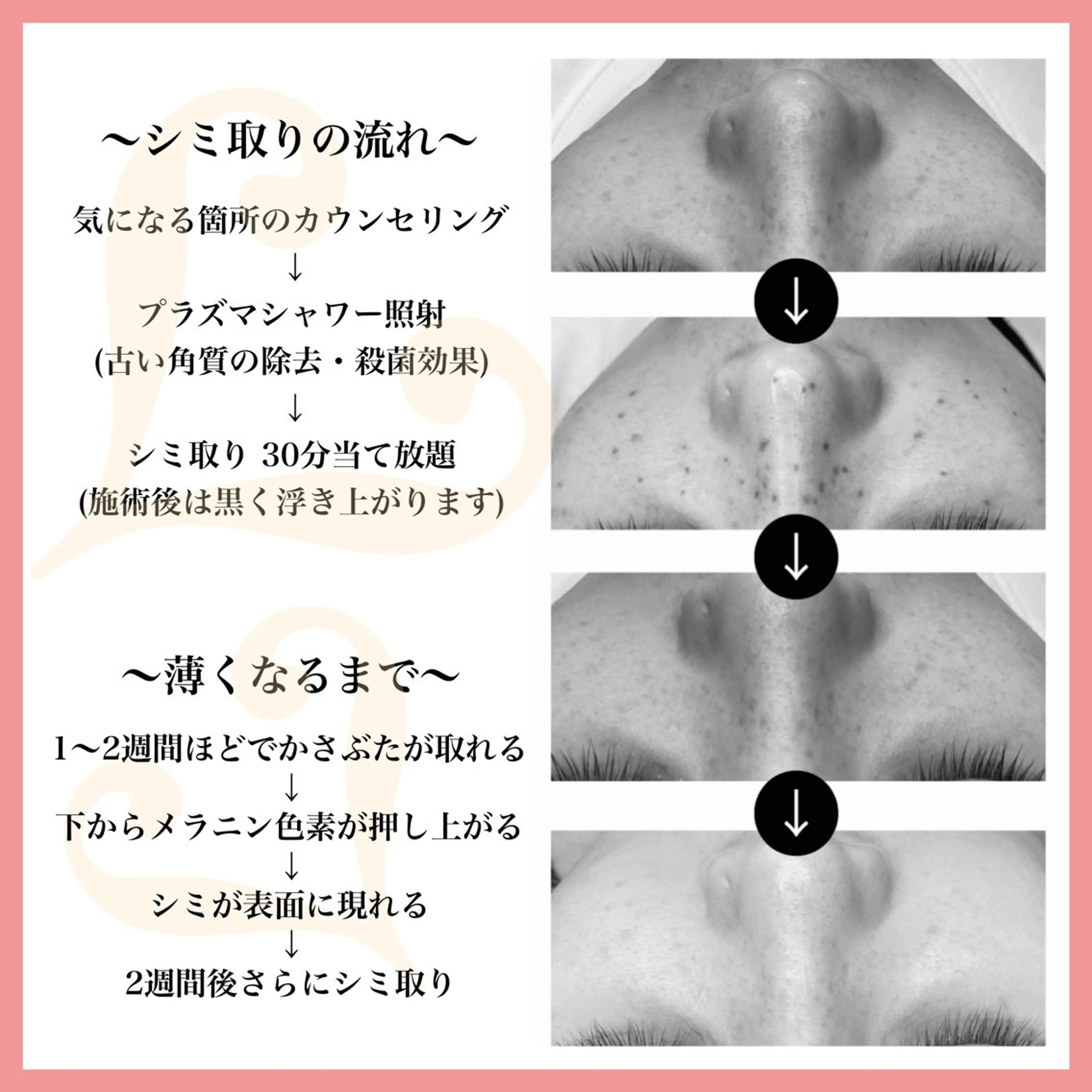 エステ 脱毛&フェイシャル 専門店muro.のエステ・リラクイメージ