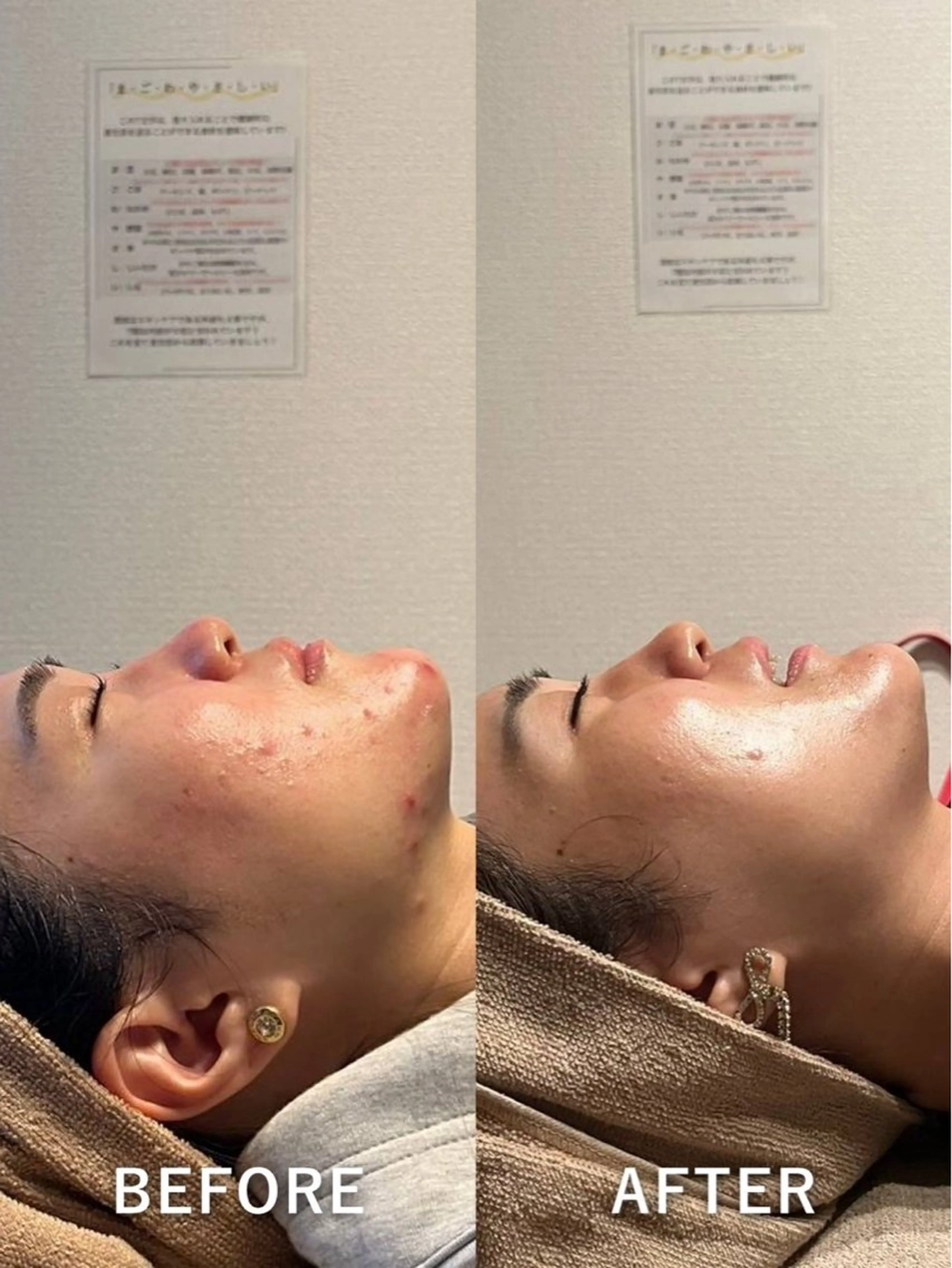 エステ 💎美容革命ラボ💎 大名店のエステ・リラクイメージ