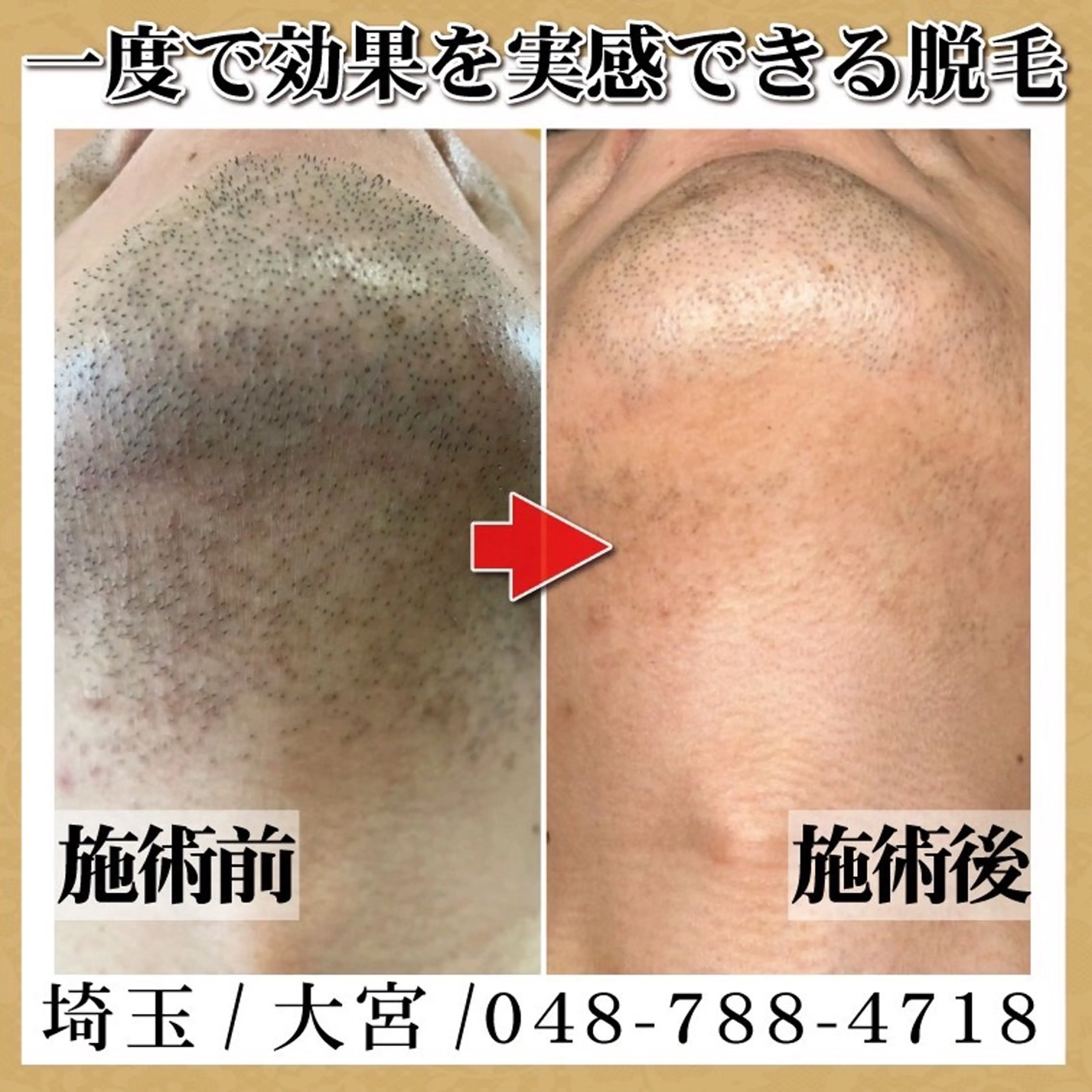 脱毛＆フェイシャル TOWA大宮のエステ・リラクイメージ