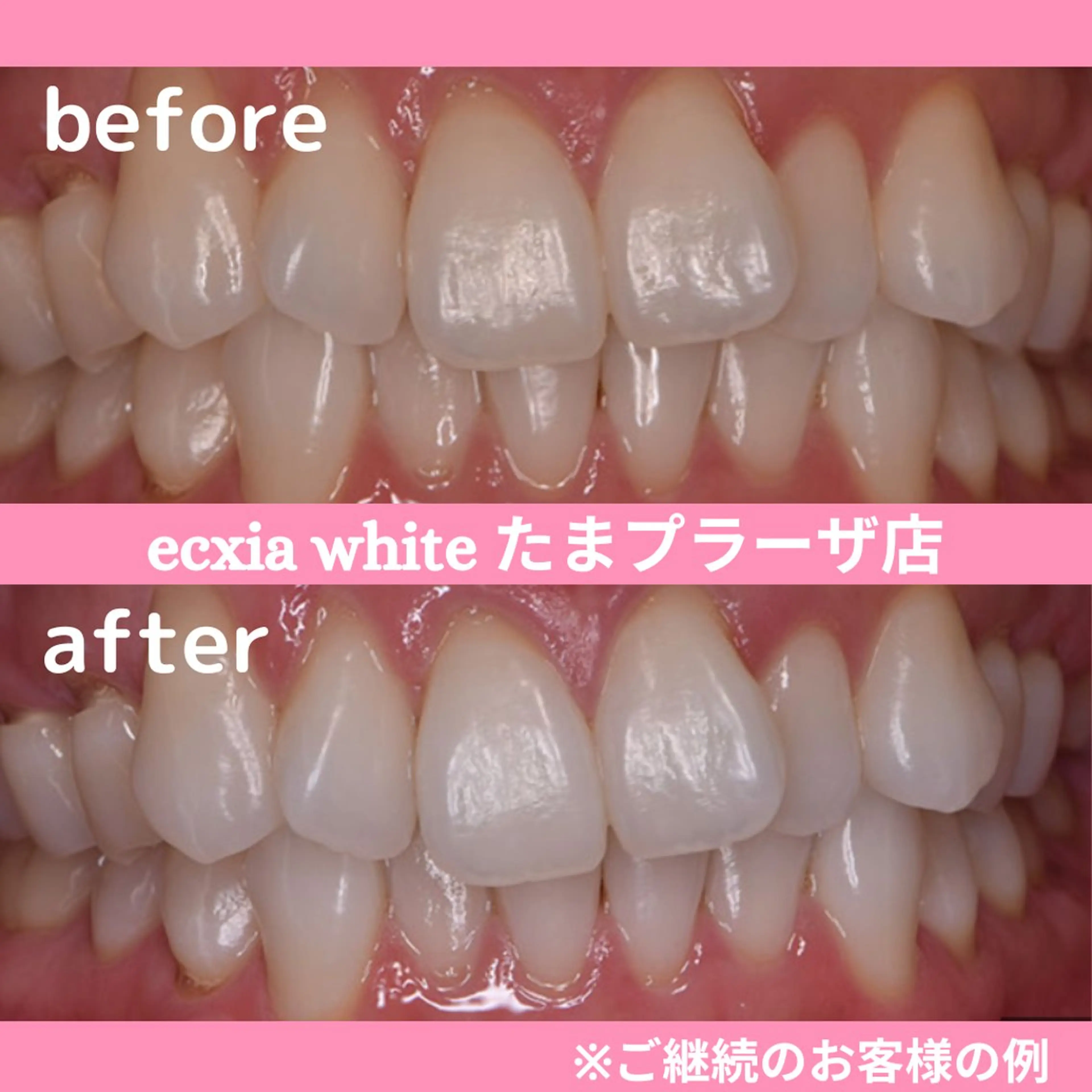 セルフホワイトニング　エクシアたまプラーザ店所属・セルフホワイトニング エクシアたまプラーザのその他イメージ