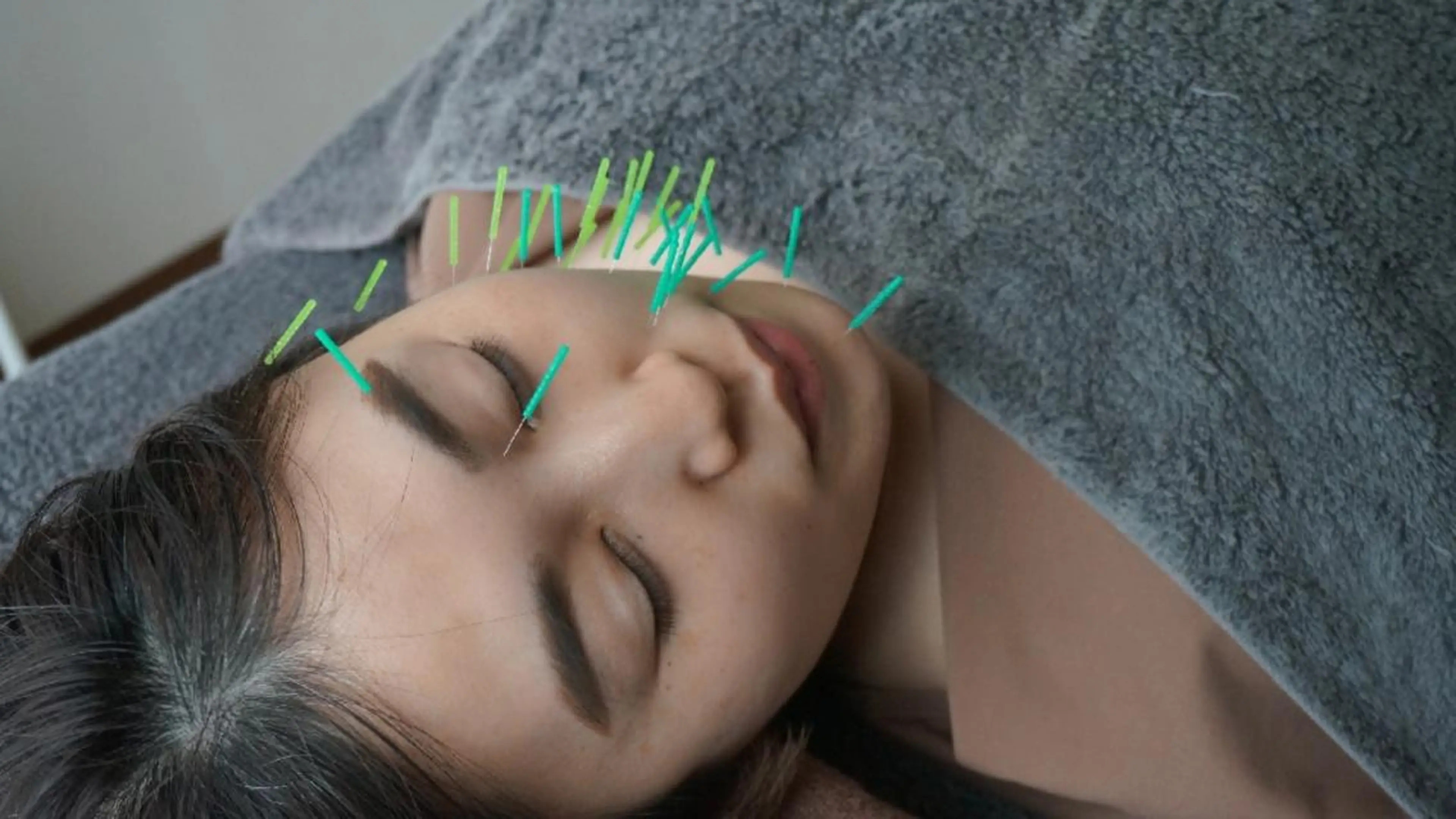 エステ リラク 即効⚡小顔美容鍼🪡 むくみたるみ脂肪解消のエステ・リラクイメージ