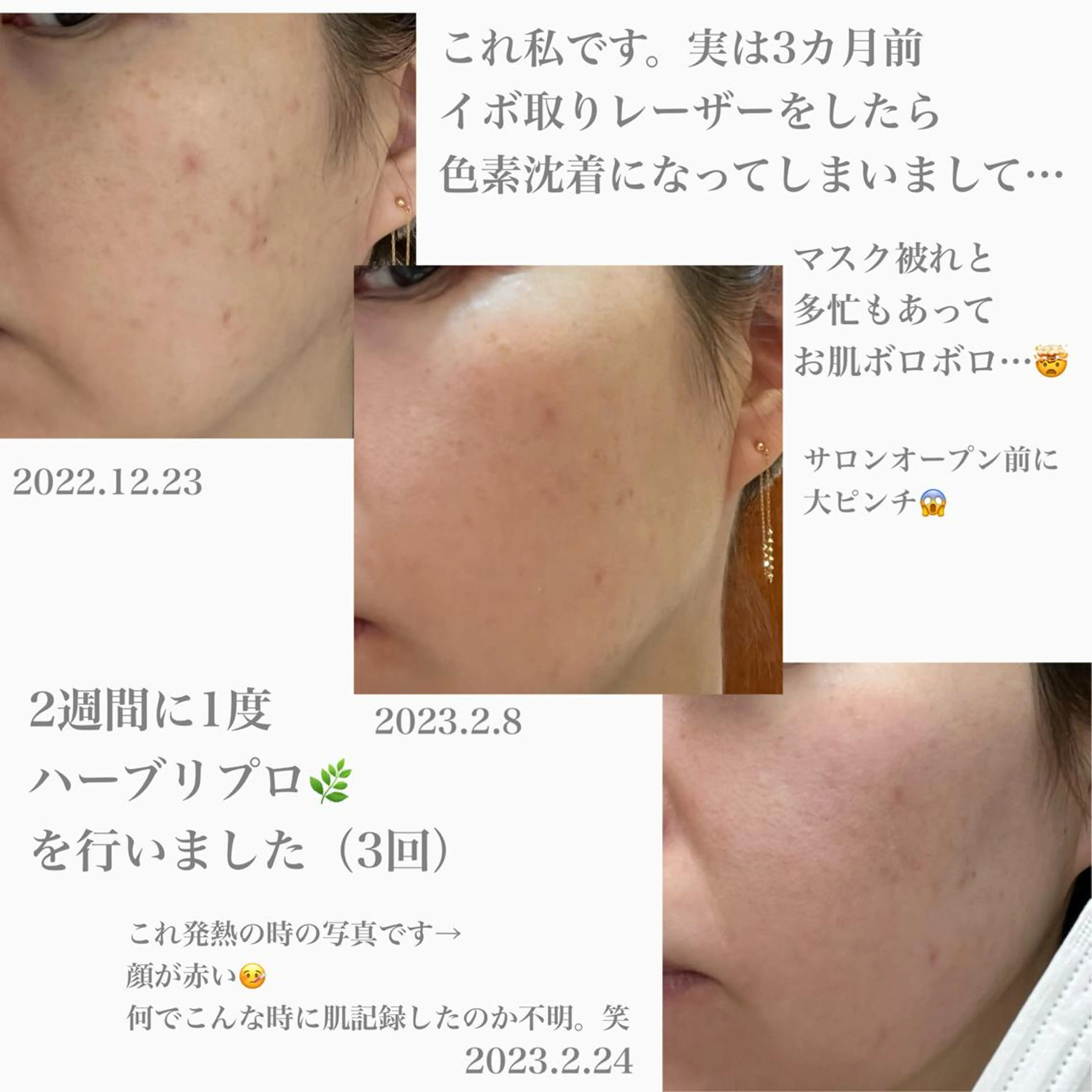 1ヶ月後も半分残る 高持続LEDエクステのマツエク・マツパデザイン