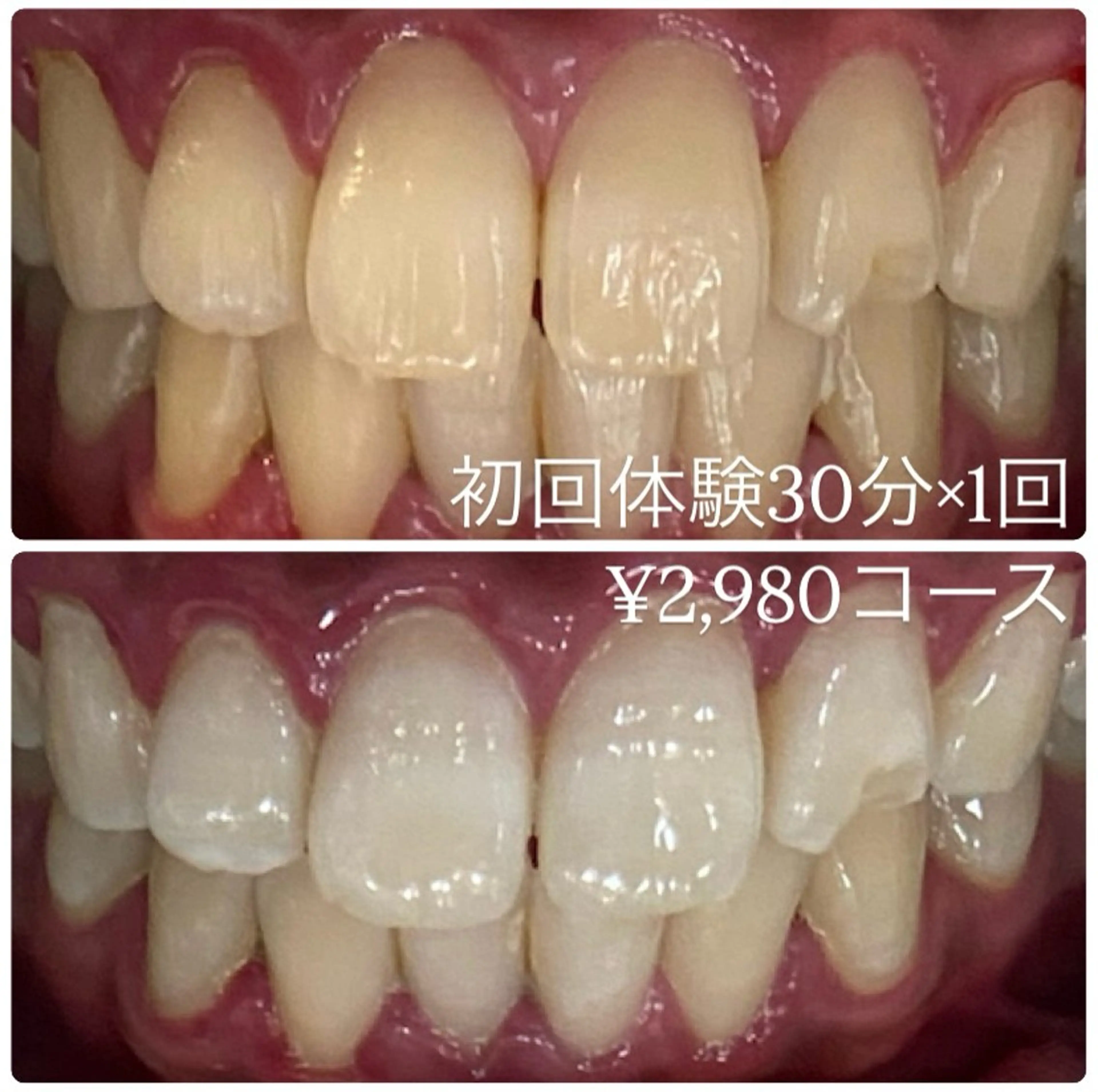 PLATINUM Beauty 横浜店所属・ホワイトニングルーム 横浜店のその他イメージ