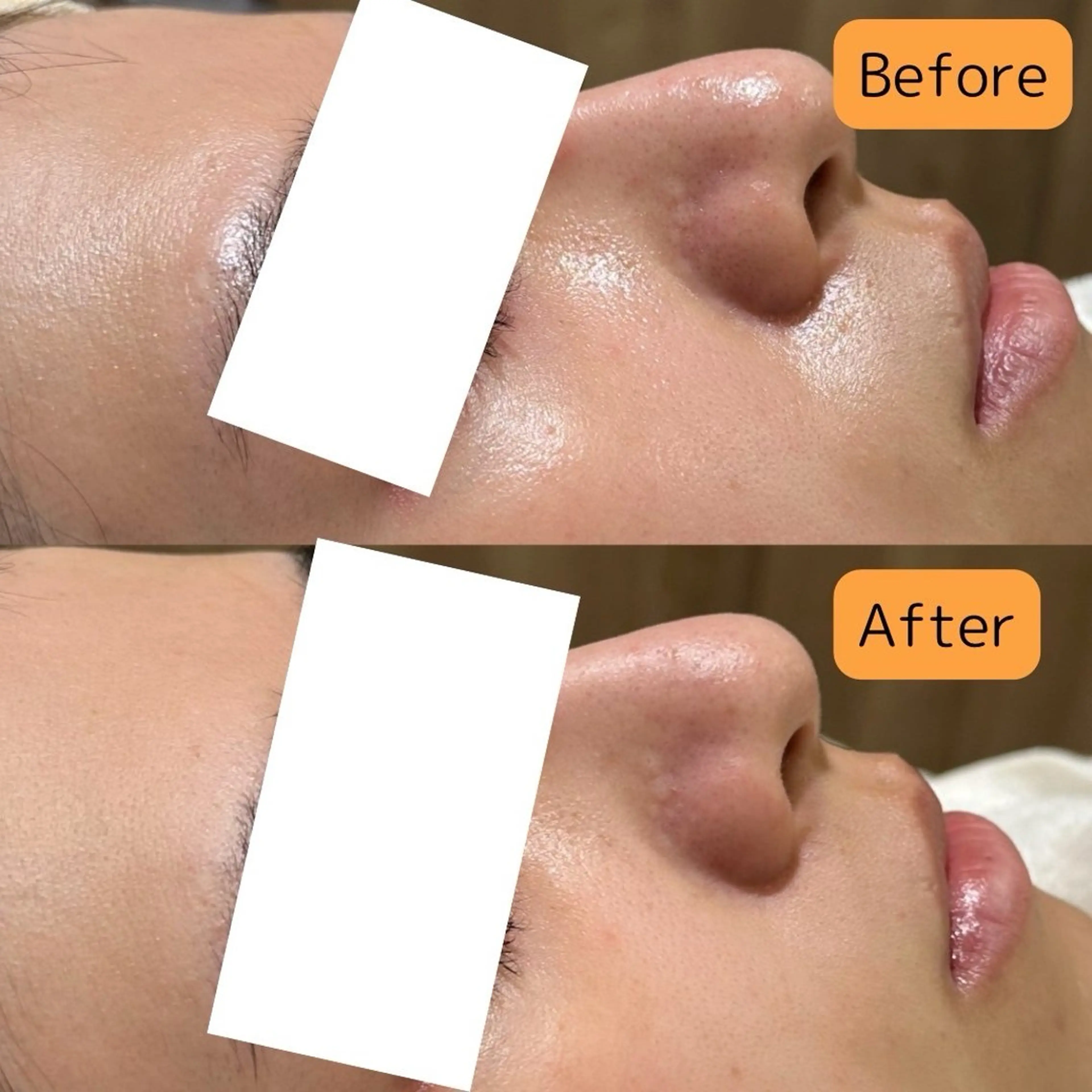 肌質改善美容サロン ému 用賀のエステ・リラクイメージ