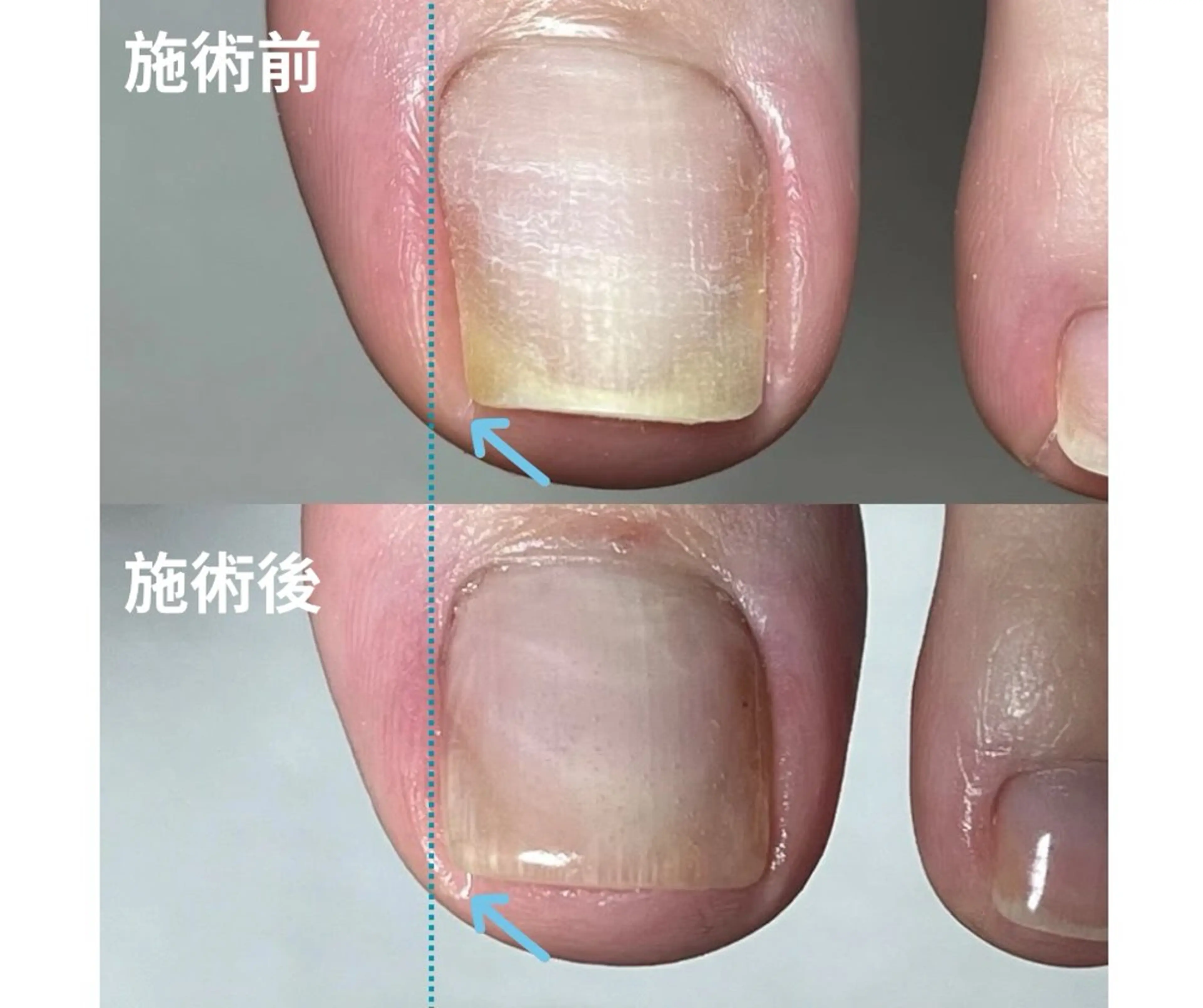 ネイル フットネイル rangrang nailのネイルデザイン