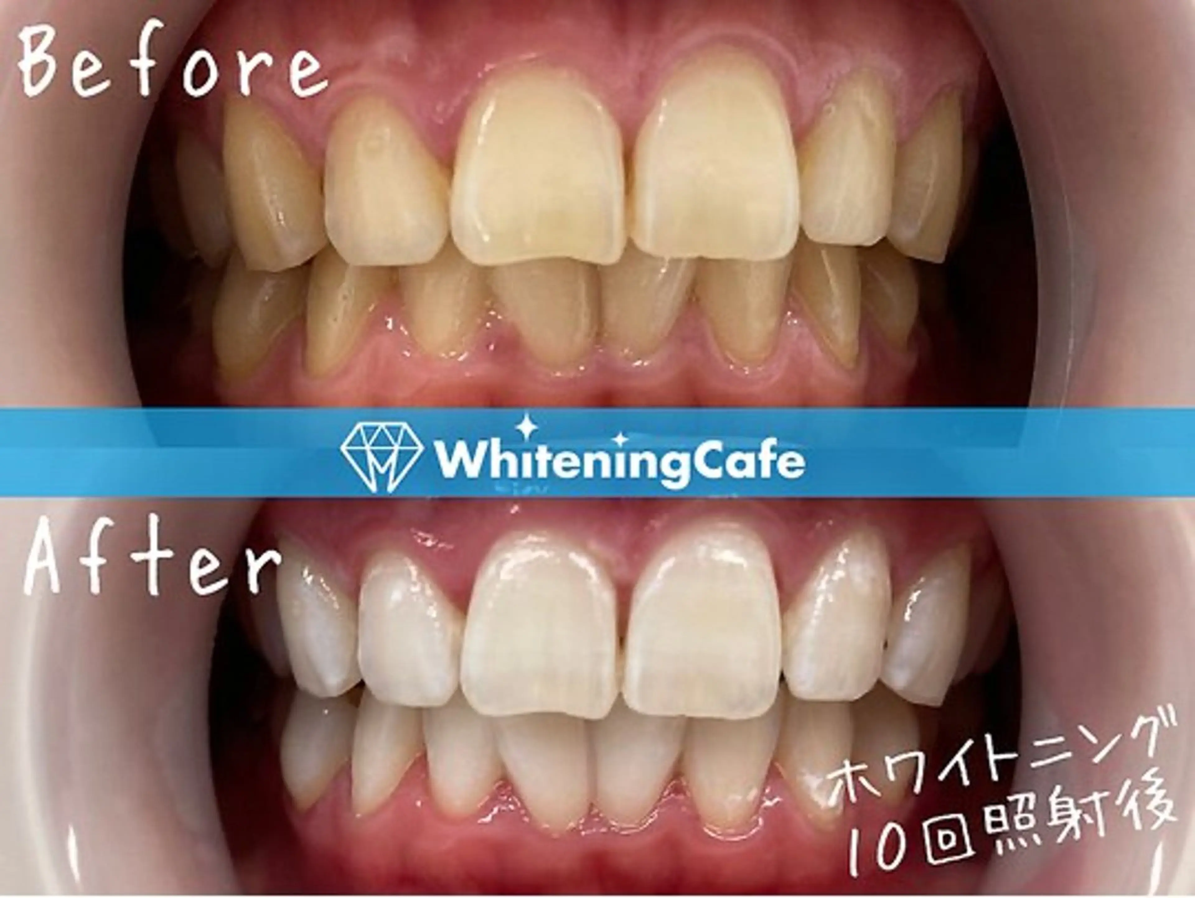 ホワイトニングカフェ荻窪店所属・ホワイトニングカフェ 荻窪店のその他イメージ