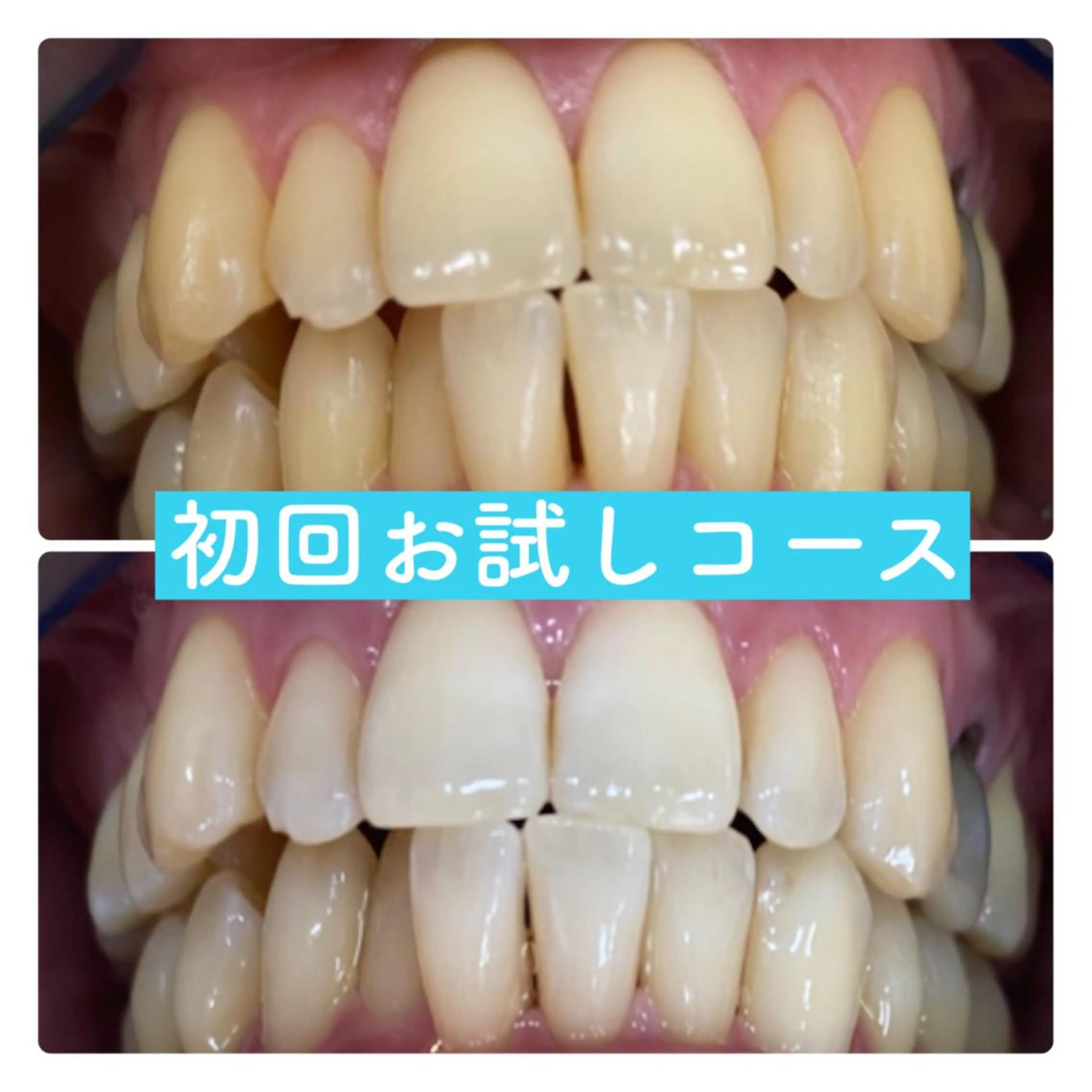 その他 PLATINUM Beauty 横浜店所属・ホワイトニングルーム 横浜店のその他イメージ