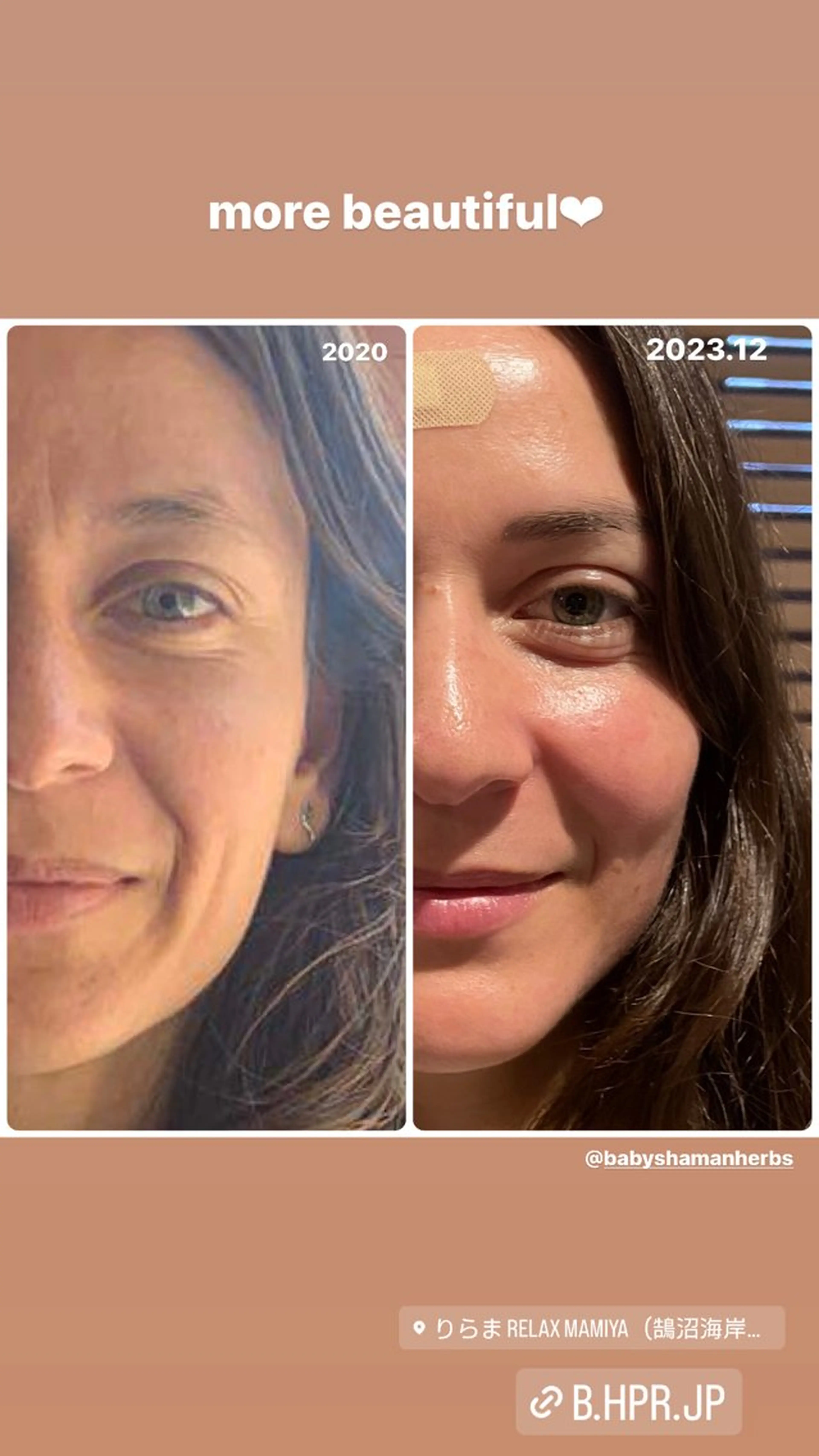 エステ リラク Relama　美容鍼×マッサージ所属・Relama/リラマ 美容鍼×マッサージのエステ・リラクイメージ