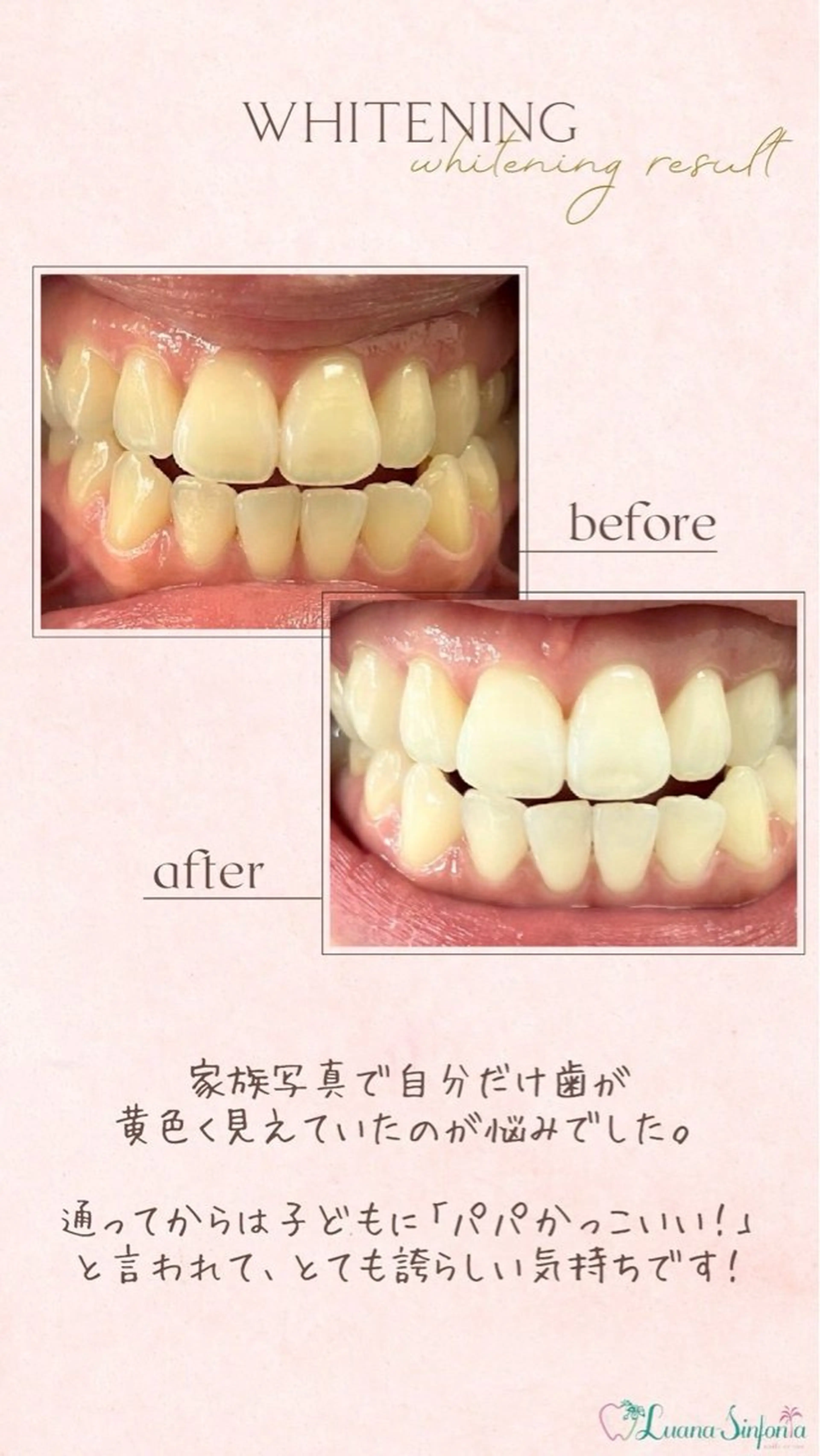 ホワイトニングサロンLuana-Sinfonia(エクシア)池袋店所属・セルフホワイトニング エクシア 池袋店のその他イメージ