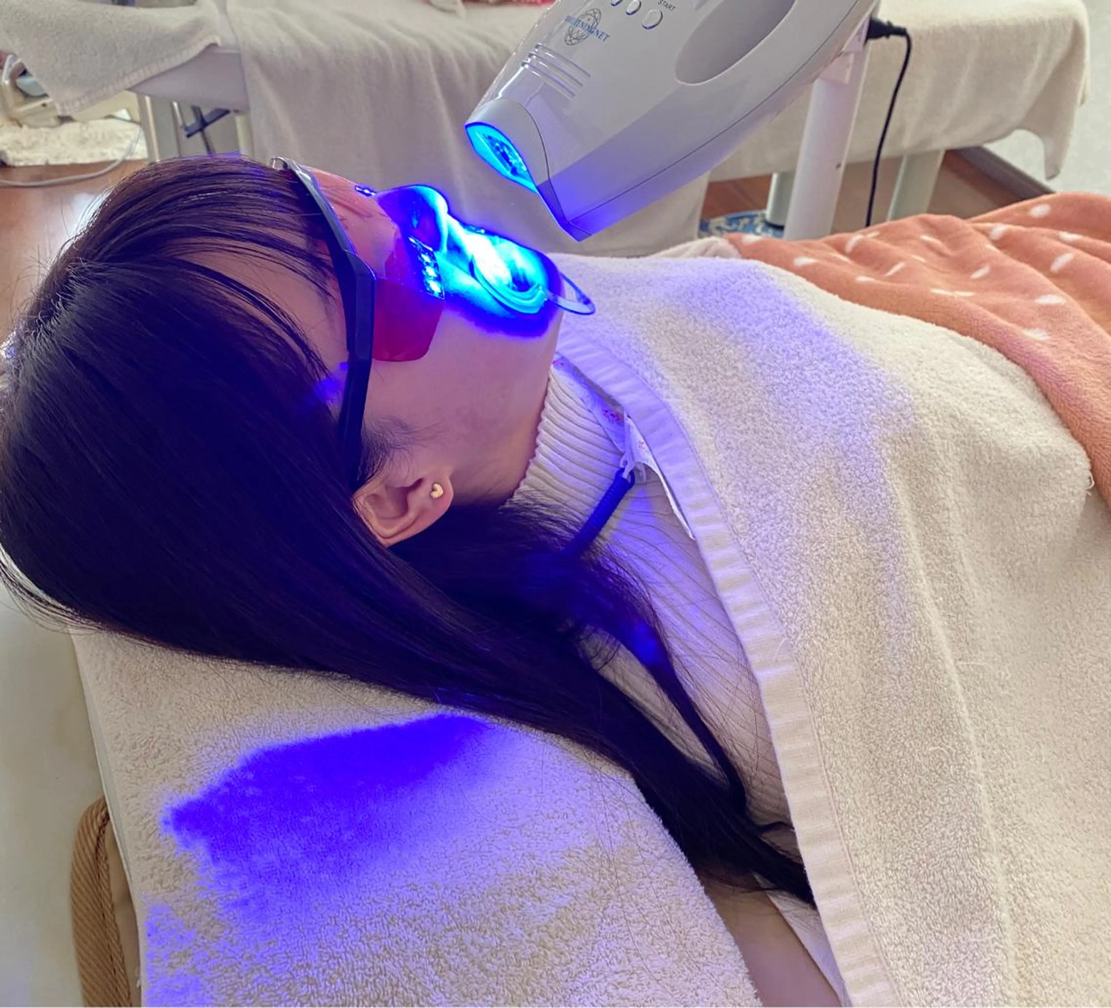 セルフホワイトニング最新マシーン キャンペーン中期間限定セール年々黄色くなる前に歯を白く輝に半額以下の写真