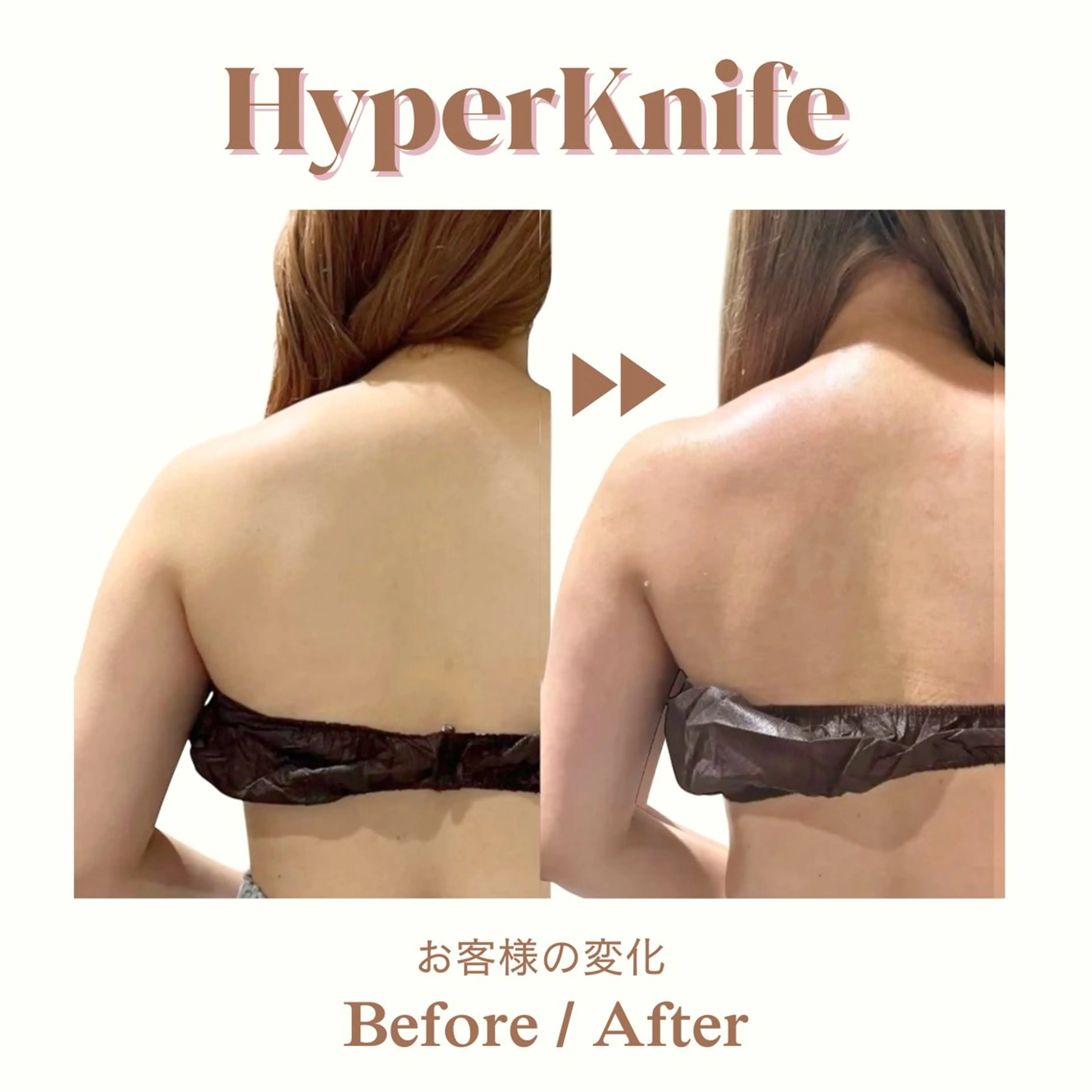 エステ aimer 服部のその他イメージ