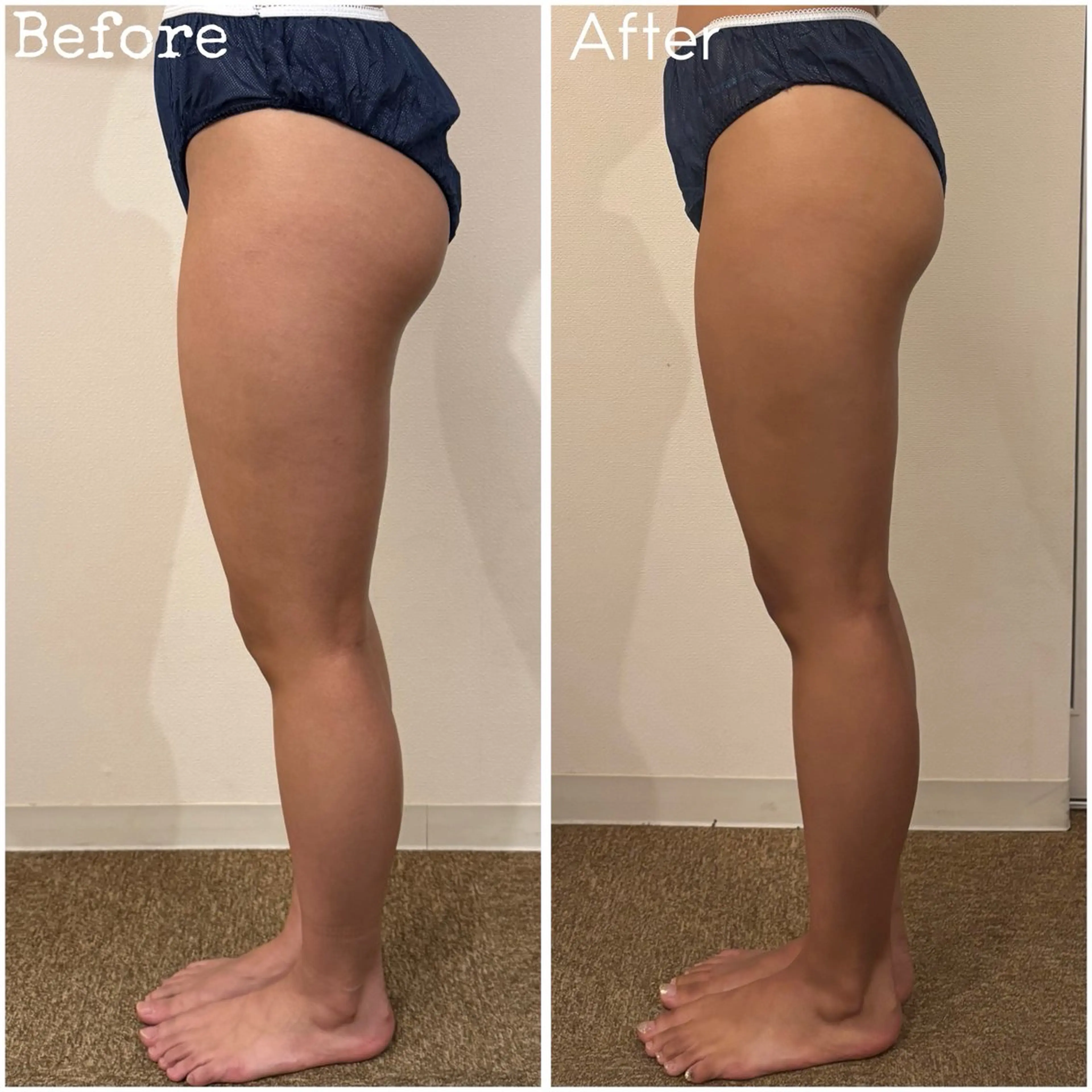 エステ リラク 坂下 千歩のエステ・リラクイメージ